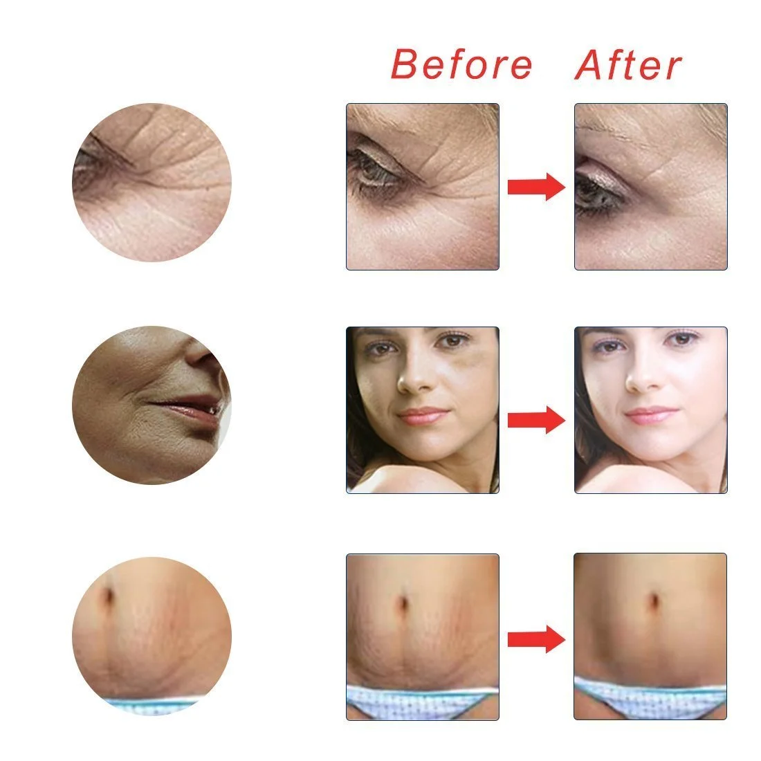 Дермароллер Титановый с Микроиглами для Ухода за Лицом и Телом, Способствует Росту Бороды у Мужчин, Уменьшает Выпадение Волос (0,5 мм), фото №6