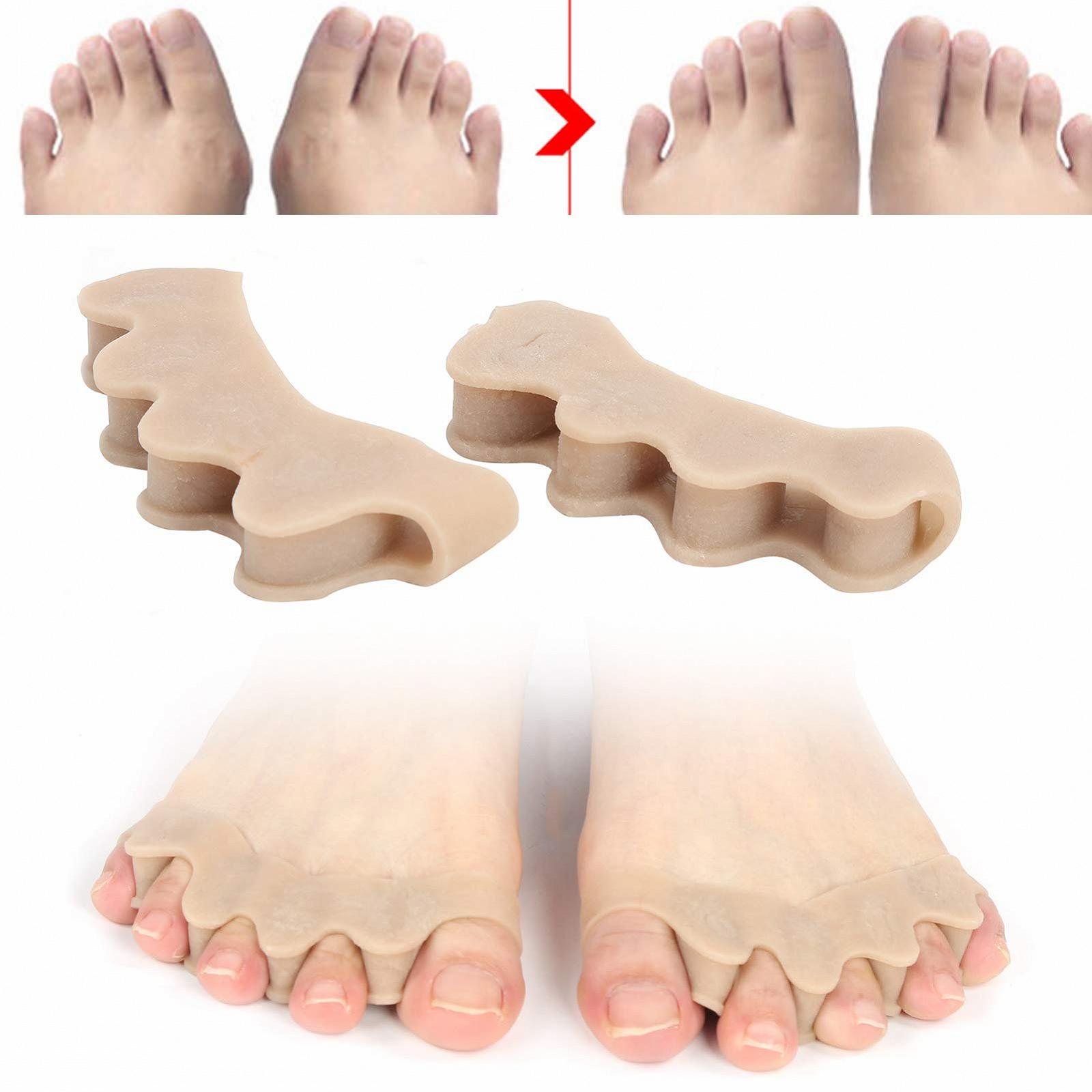 Коректор великого пальця стопи Hallux Valgus Унісекс Силіконовий роздільник для пальців ніг, фото №7