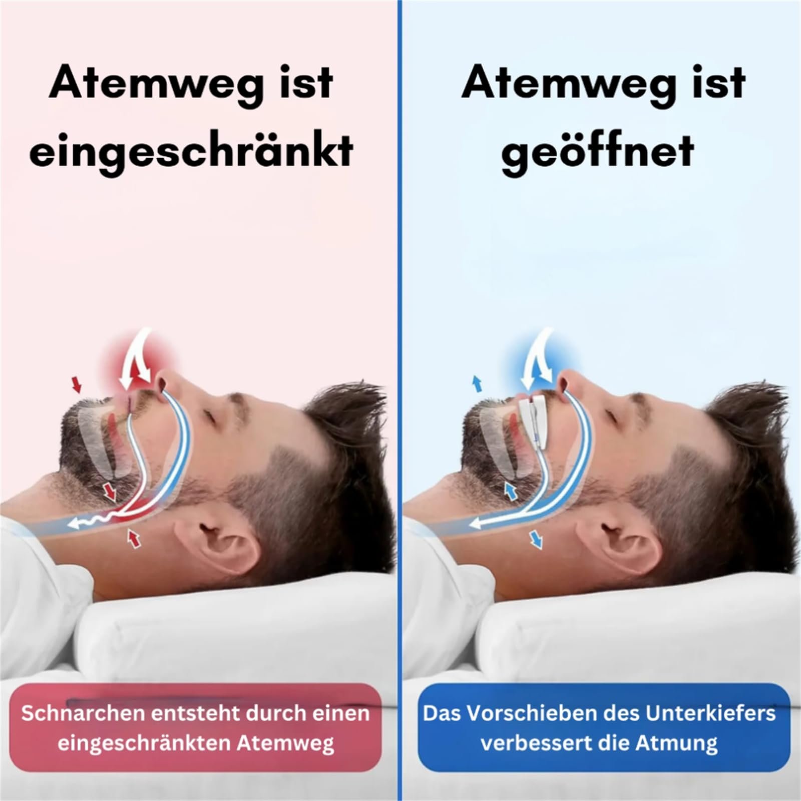 Кліпса проти хропіння Pomera Багатофункціональна, фото №5