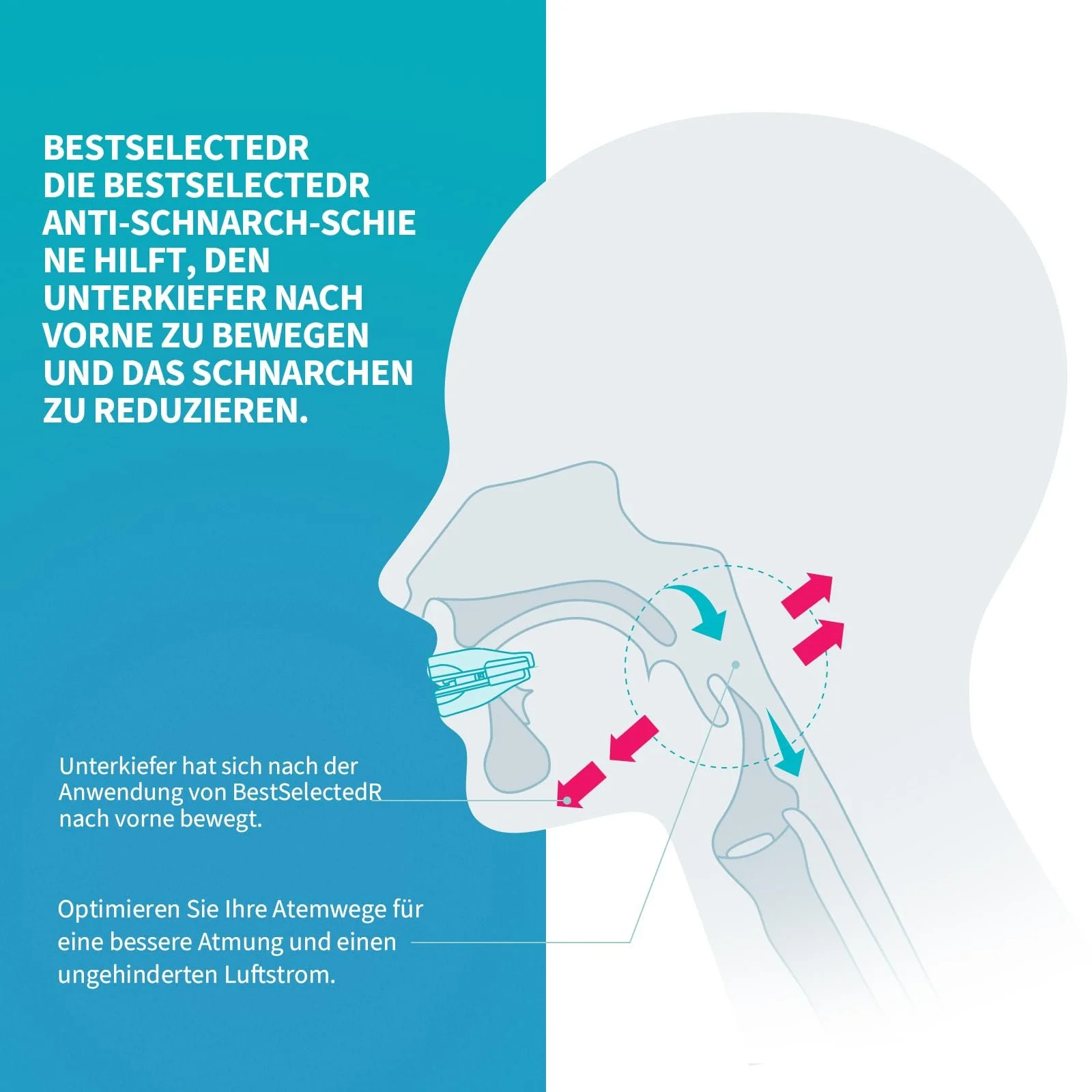 Стопер від хропіння для чоловіків і жінок, фото №3