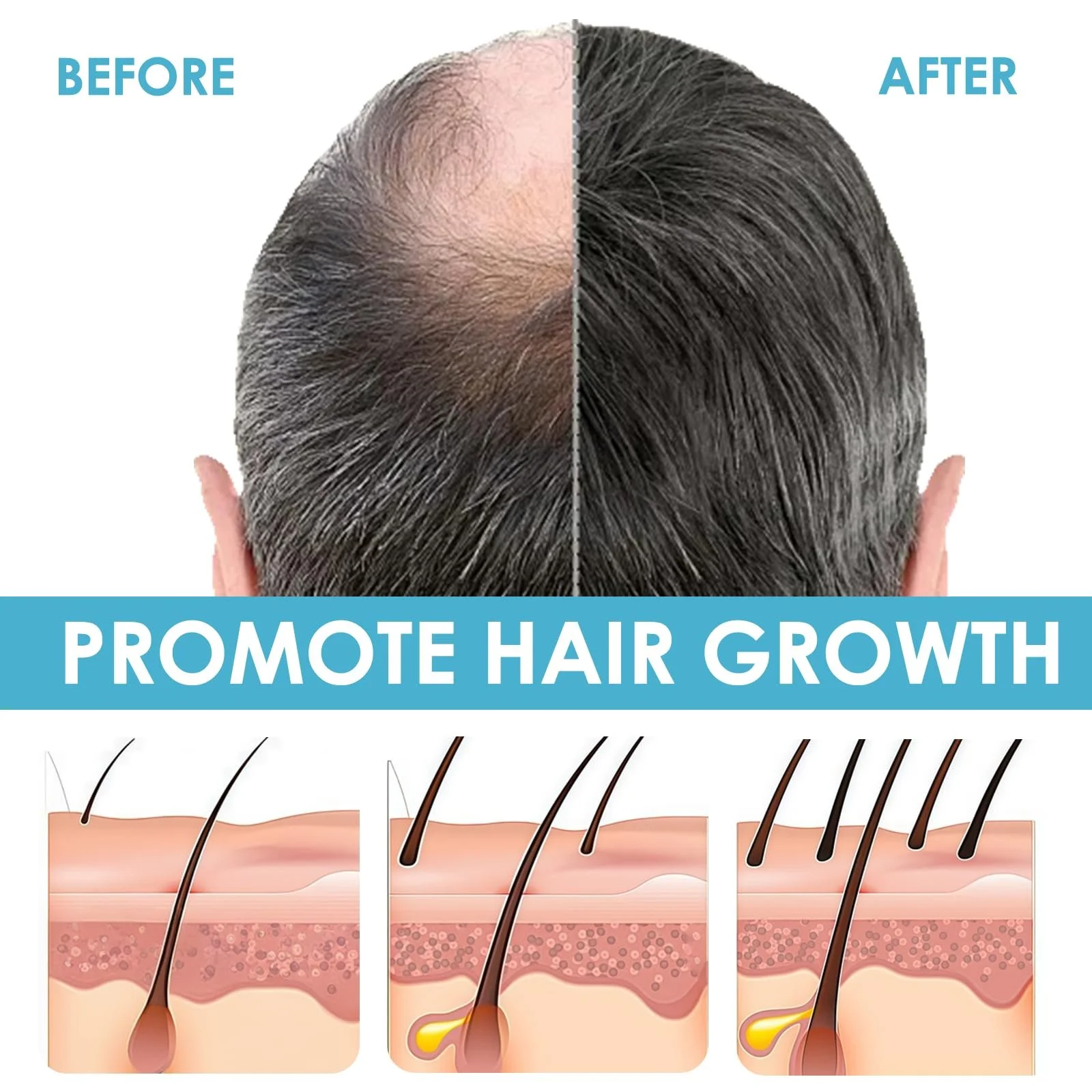 Сироватка для росту волосся 60 мл, проти випадіння волосся для жінок і чоловіків, фото №4