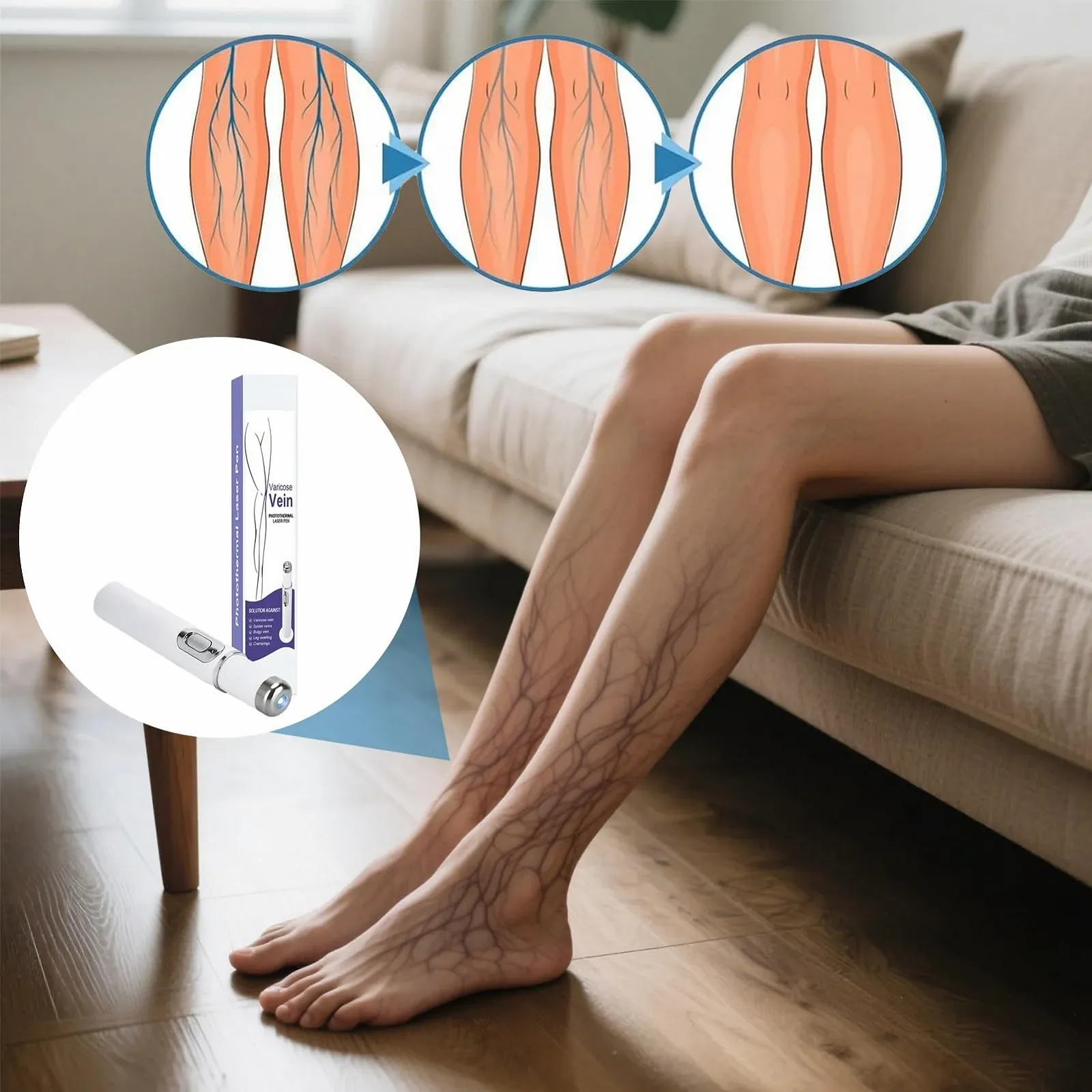 Портативний пристрій для догляду за шкірою та видалення судинних зірочок на ногах, фото №2