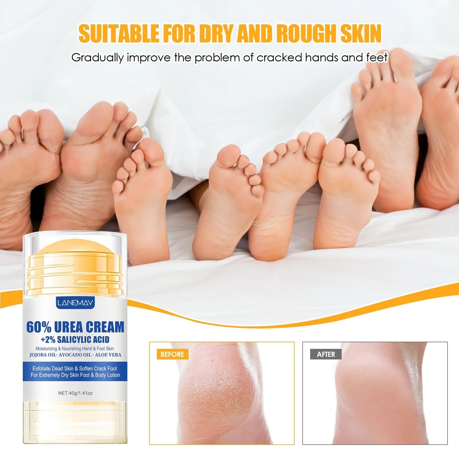 Крем для ног увлажняющий против трещин с 60% мочевины, фото №2 Крем для ног увлажняющий против трещин с 60% мочевины, фото №2