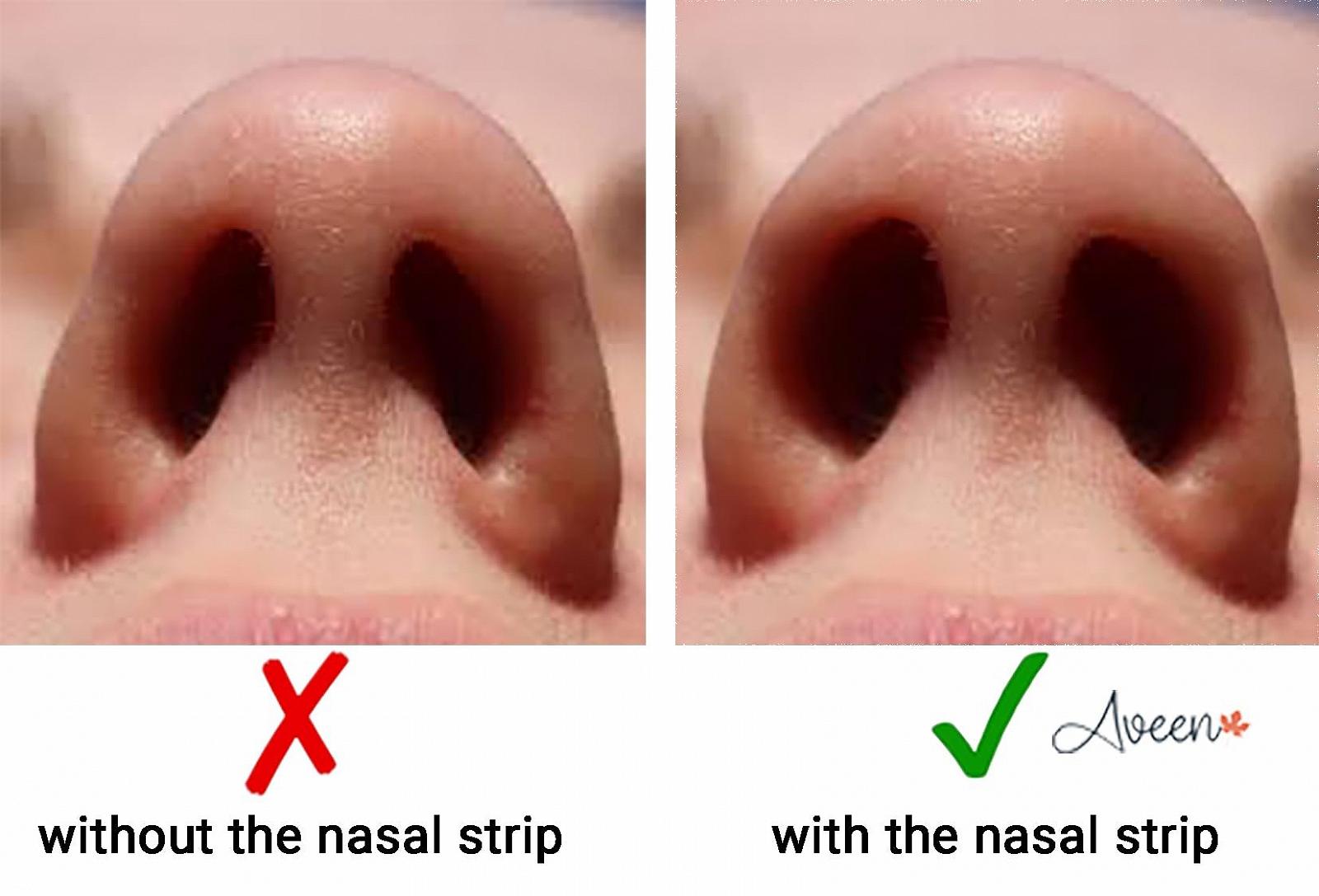 Смужки для носа Aveen проти хропіння для глибокого, спокійного сну Ефективне рішення, фото №5 Смужки для носа Aveen проти хропіння для глибокого, спокійного сну Ефективне рішення, фото №5