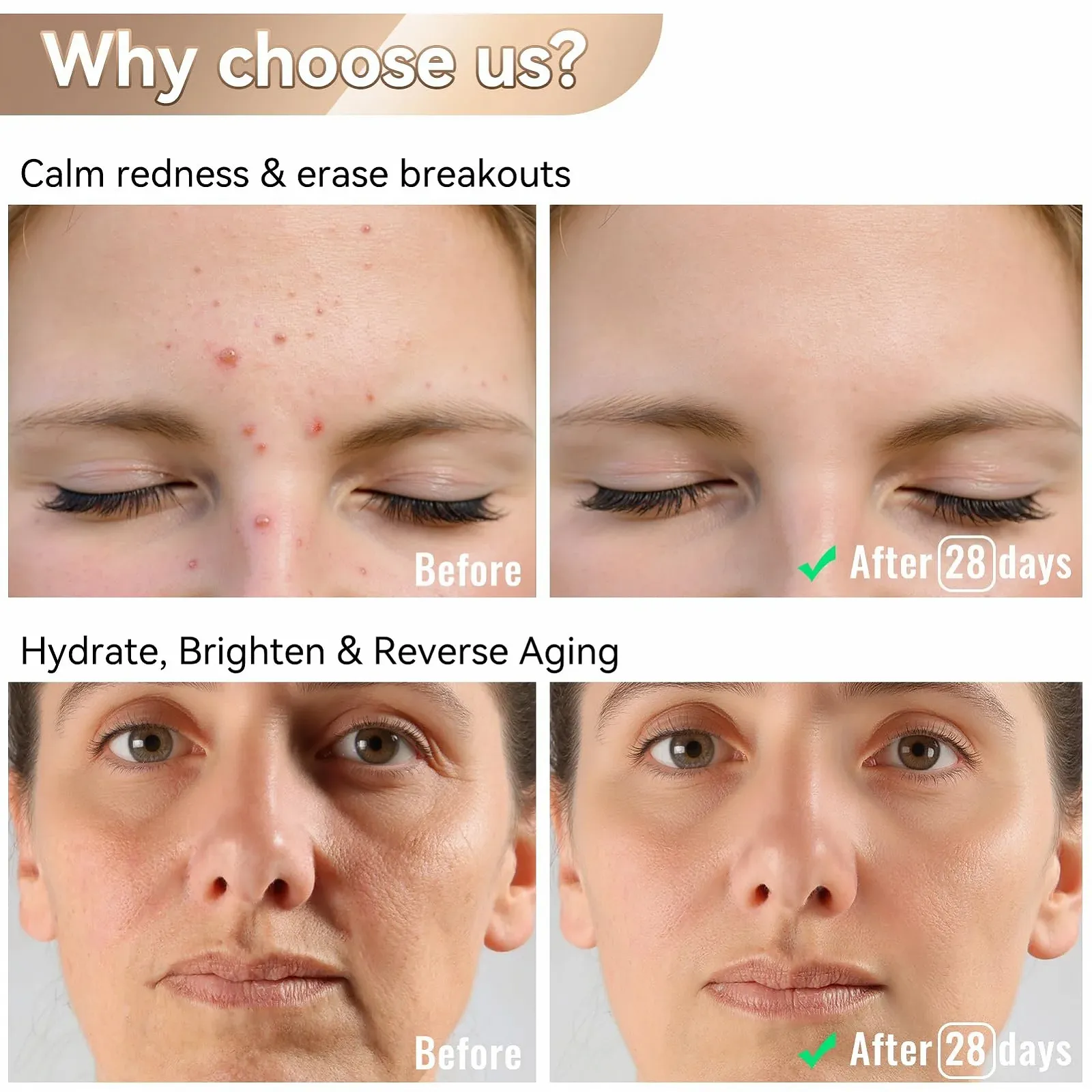 LED Маска для Лица 400 LED - Красная Светотерапия для Антивозрастного ухода и омоложения кожи, фото №4 LED Маска для Лица 400 LED - Красная Светотерапия для Антивозрастного ухода и омоложения кожи, фото №4