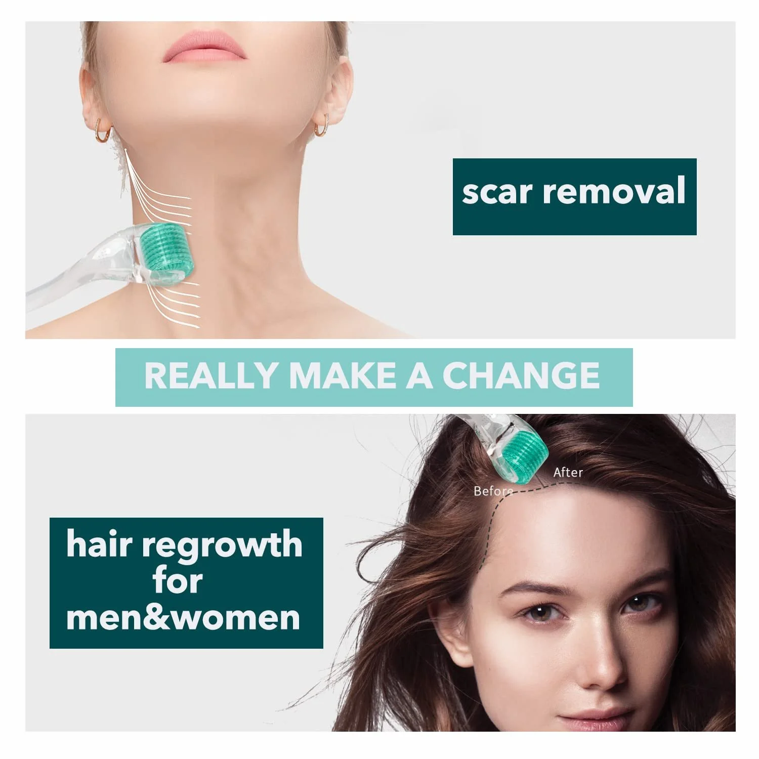 Ролик Derma AUDUODUO 192 голки 0.5 мм Срібні голки для обличчя, фото №4