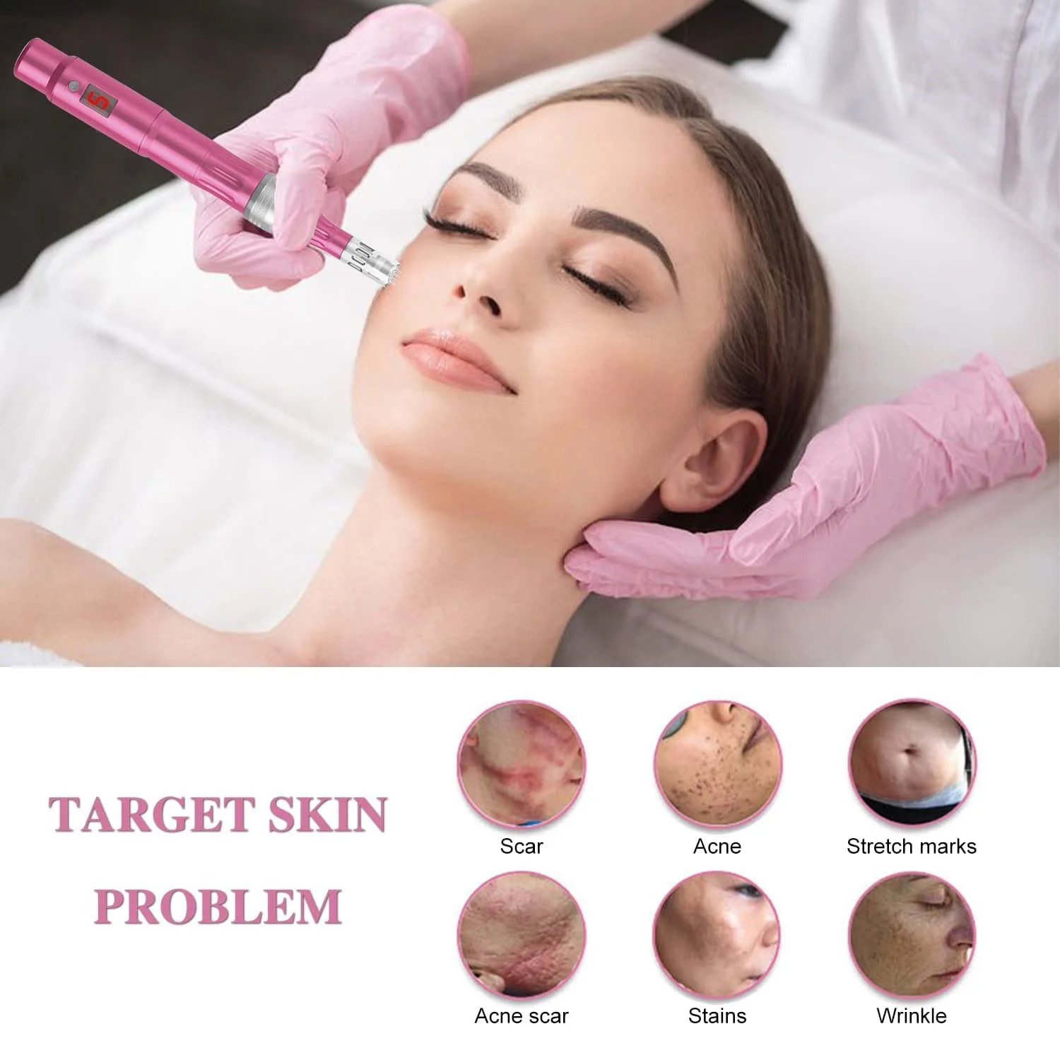 Пристрій для мікронідлінгу INCELLICE Derma Pen Electric Professional, 5 рівнів, зі світлодіодним екраном, фото №5