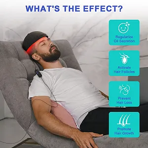 Пристрій для стимуляції росту волосся за допомогою лазерного шолома LLLT, 236 лазерних зондів synthetic.ua - Фото 1