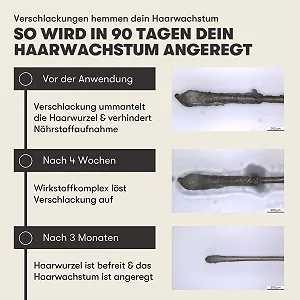 Сыворотка O.C. HAIRCARE для роста волос Overnight - Сыворотка для волос против выпадения волос - С розмарином, пантенолом и алоэ вера - Способствует росту волос - Натуральная альтернатива миноксидилу - 100 мл synthetic.ua - Фото 1