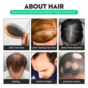 Сироватка для росту волосся Tkekruh 120 мл (2 шт.) synthetic.ua - Фото 1