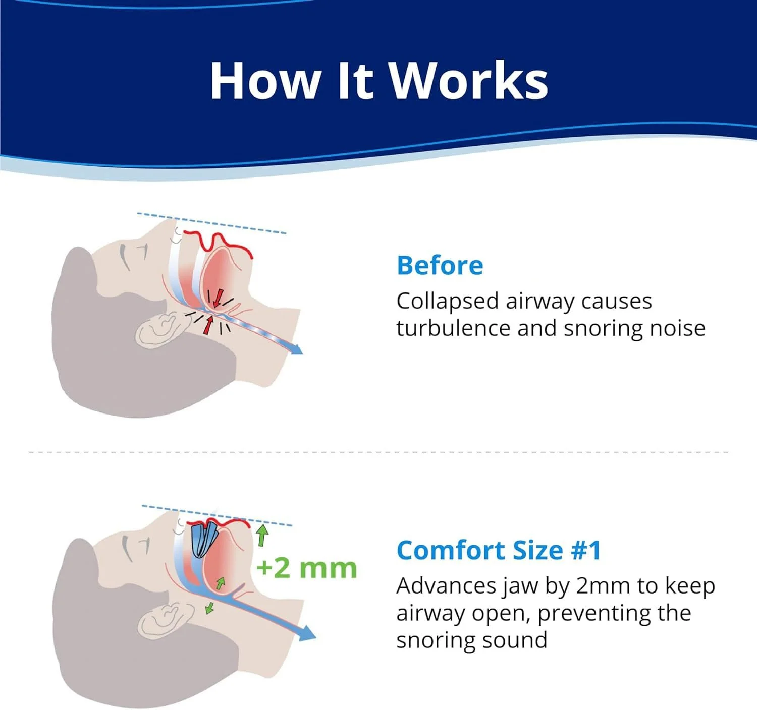 Ротовий Апарат Проти Хропіння, фото №2 Ротовий Апарат Проти Хропіння, фото №2