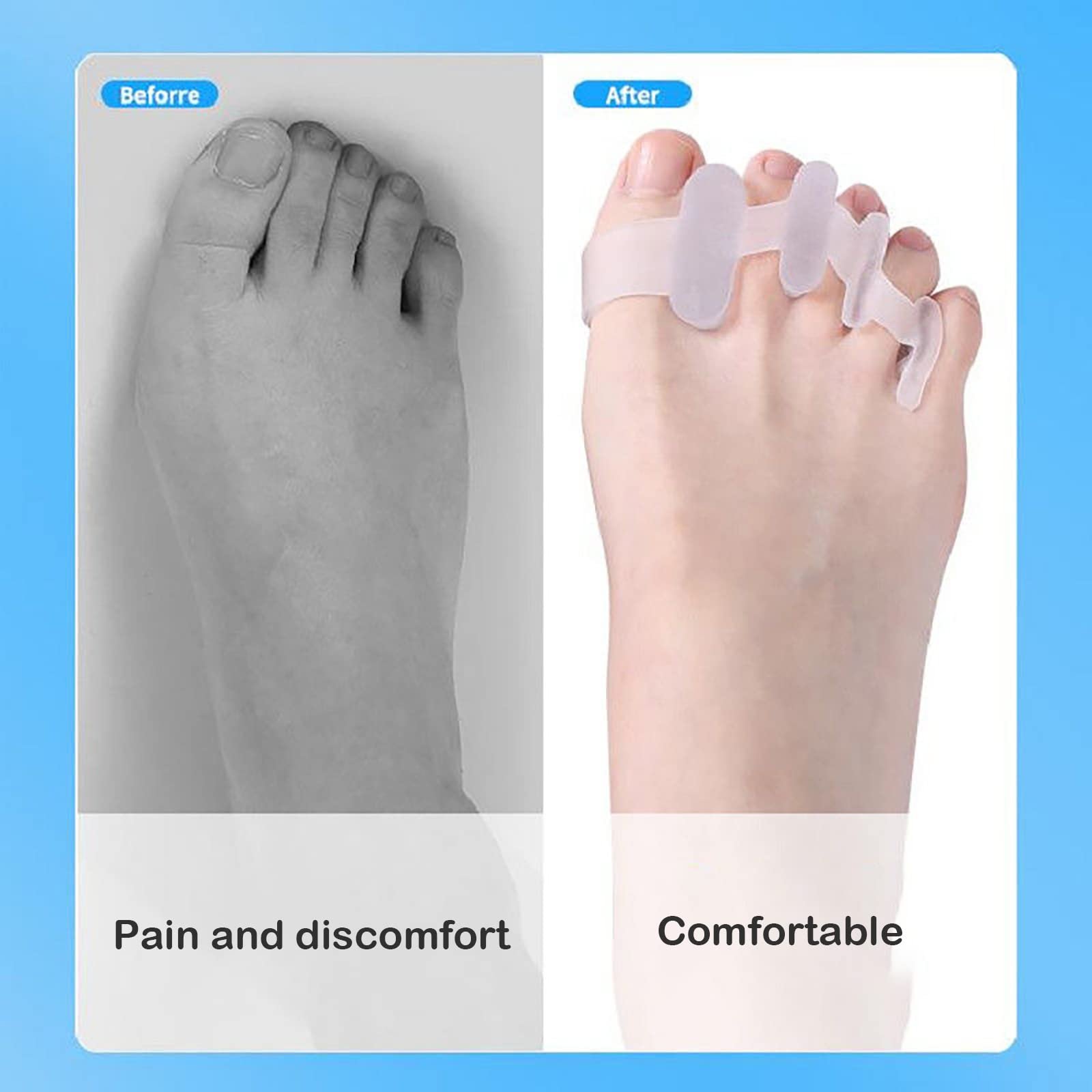 Коректор Бурси та Роздільники для Пальців, Ортопедична Шина для Полегшення Болю, фото №4