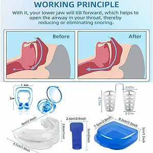 Стопери від хропіння (16 шт.) Магнітна кліпса synthetic.ua - Фото 1