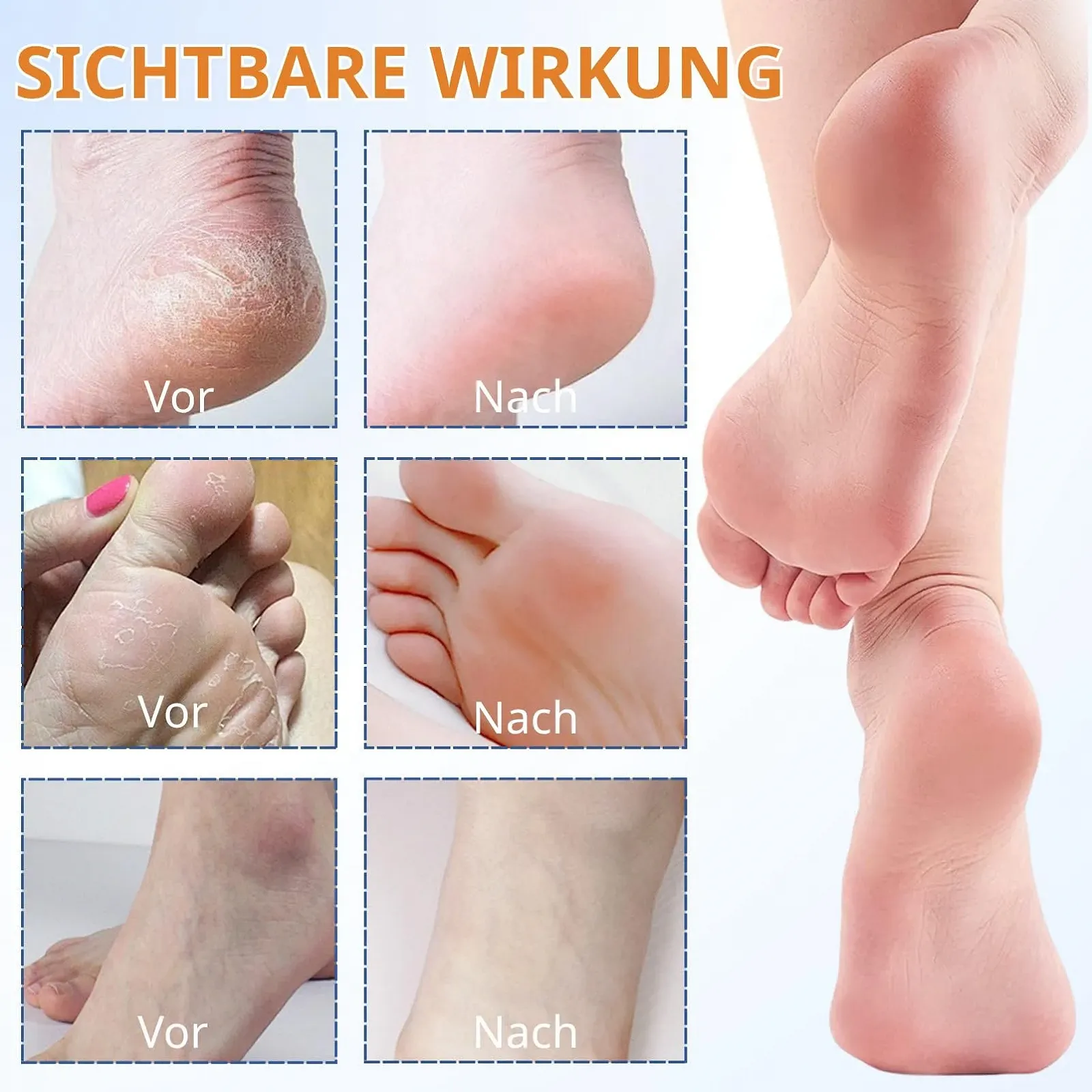 Набор для ухода за ногами Hydrating and Anti-Cracking Urea 60% для очень сухой кожи 2 шт., фото №6