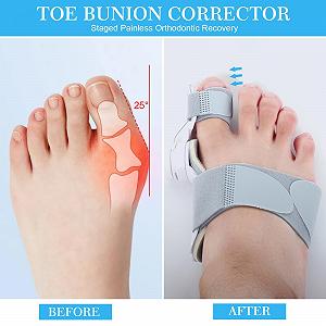 Шина для коррекции Hallux Valgus, регулируемая, 90

Регулируемая ортопедическая кнопка для левой/правой ноги, Фиксационная пластина для коррекции Hallux Valgus с разделителем для пальцев, Hallux Valgus synthetic.ua - Фото 1