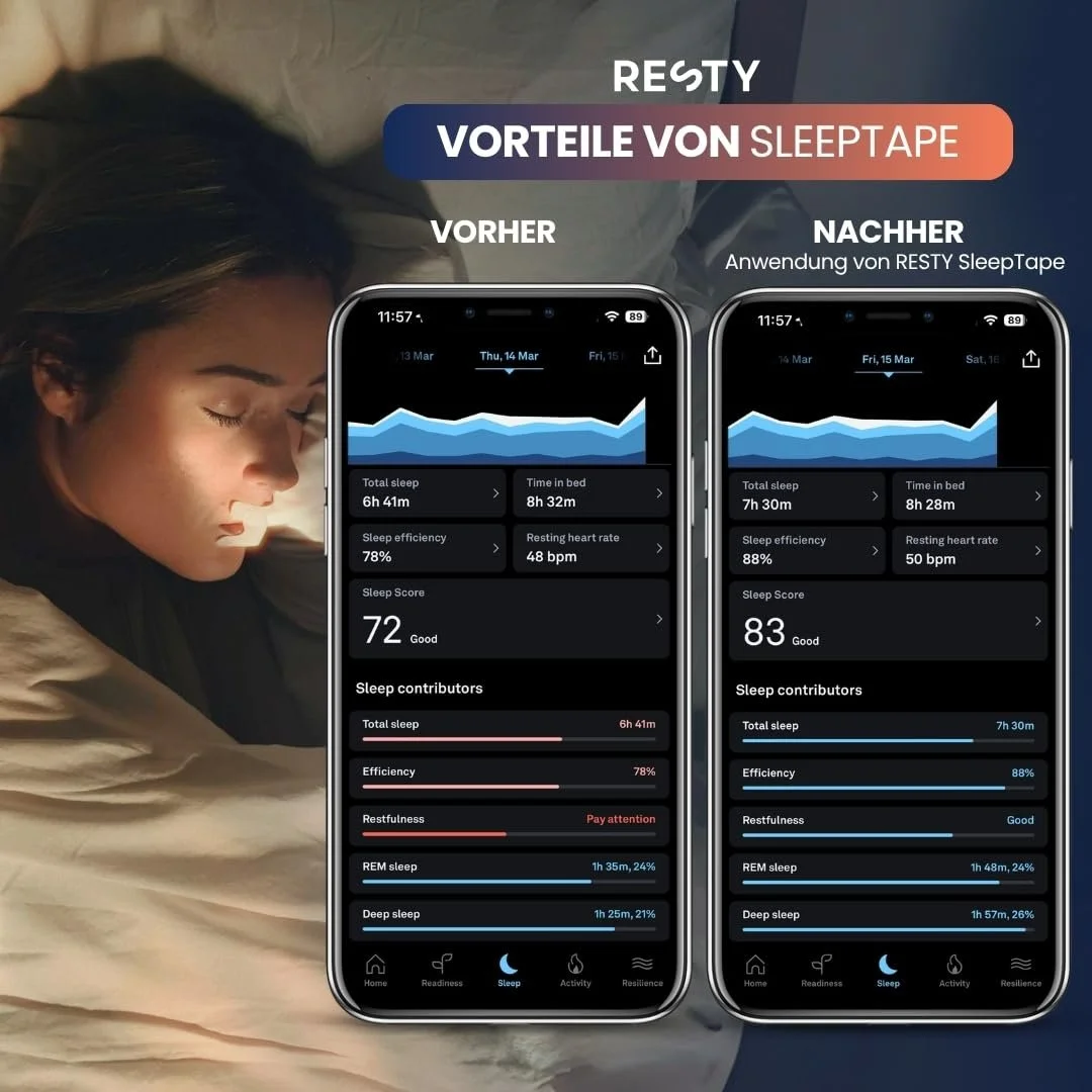 Пластирі для рота Resty Форма: H-подібна Упаковка: 72 шт., фото №3 Пластирі для рота Resty Форма: H-подібна Упаковка: 72 шт., фото №3