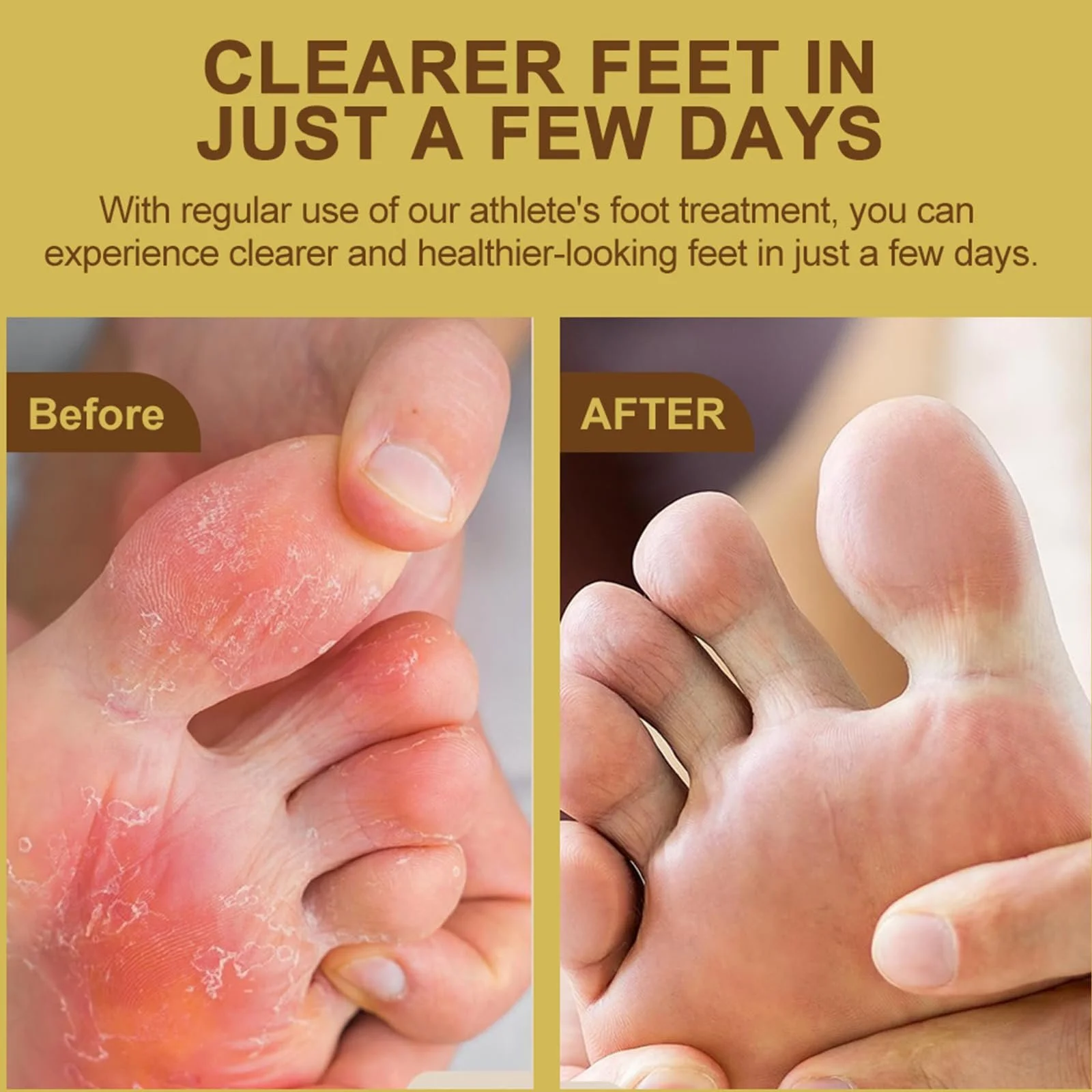 Лосьон и крем от кожного зуда и грибка стоп 2 шт., фото №4