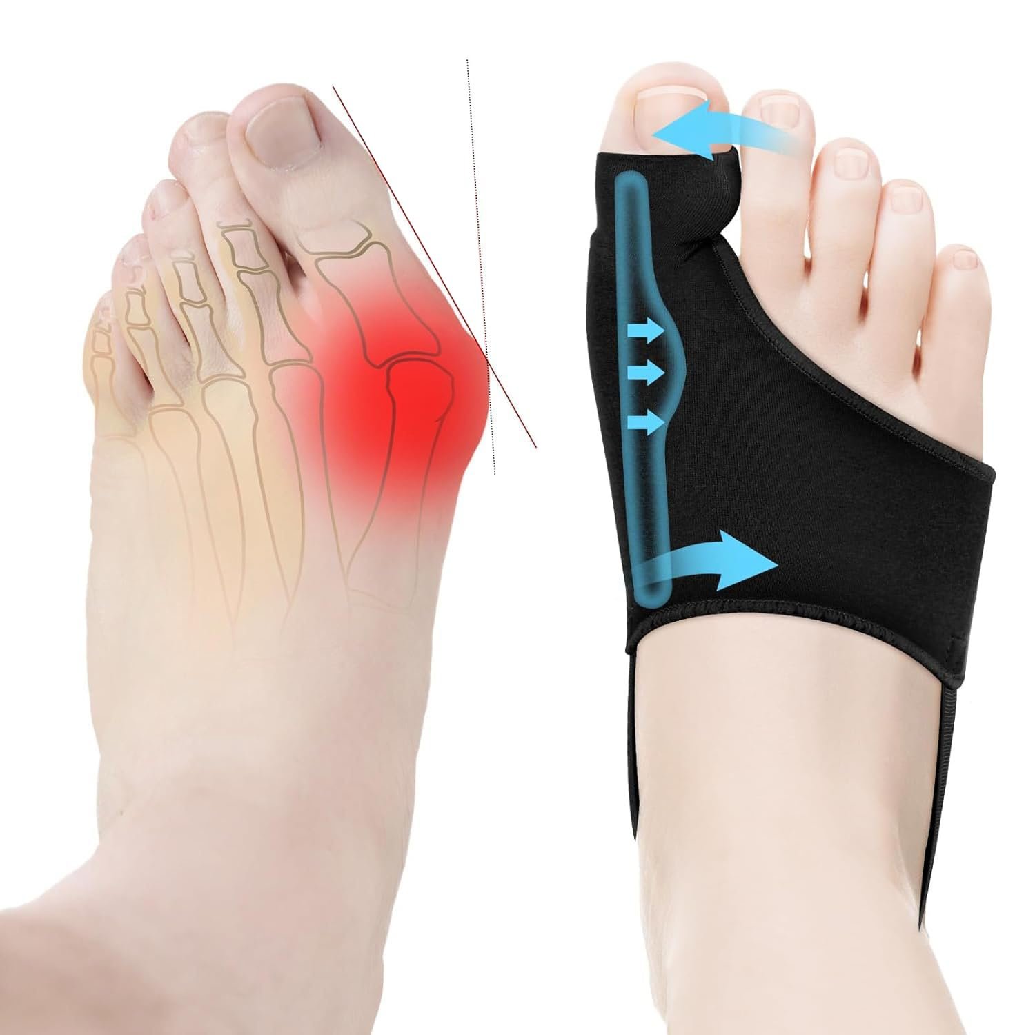 Корректор большого пальца стопы для женщин, коррекция вальгусной деформации., фото №1
