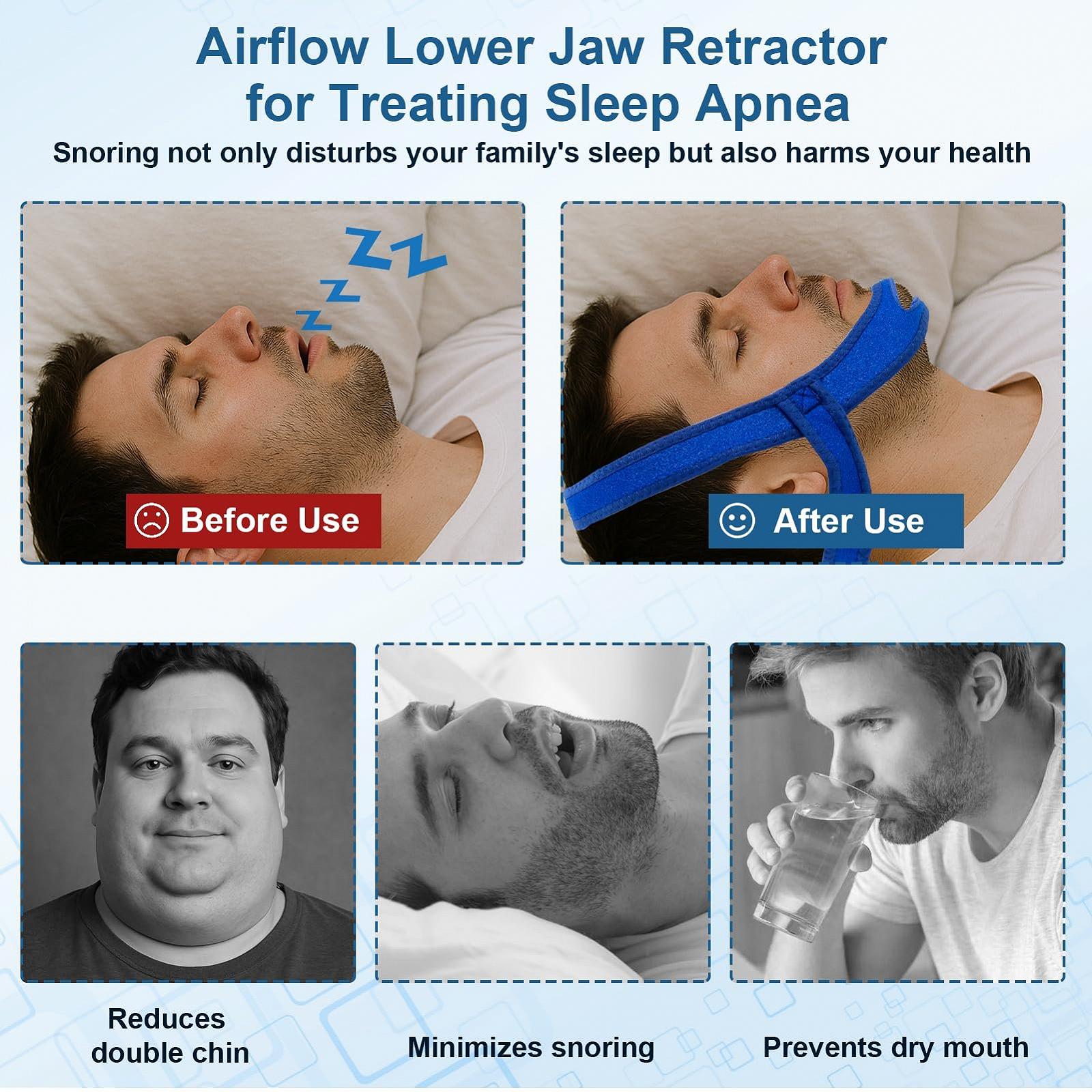 Ремінець на підборіддя Набір 6 шт. Редукція хропіння, регульований, фото №4