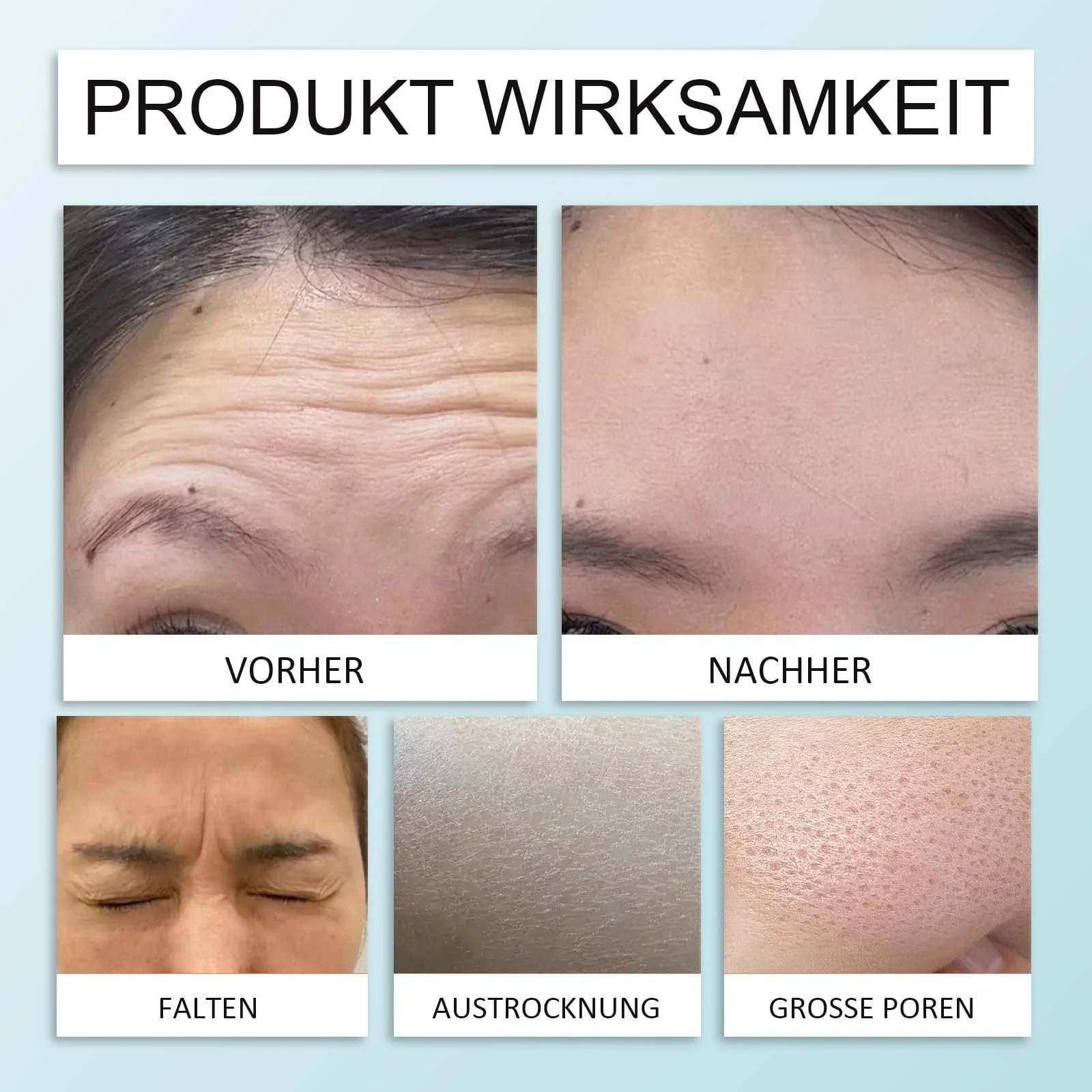 Пластыри от морщин с коллагеном для разглаживания и увлажнения кожи лица (10 шт.), фото №5 Пластыри от морщин с коллагеном для разглаживания и увлажнения кожи лица (10 шт.), фото №5