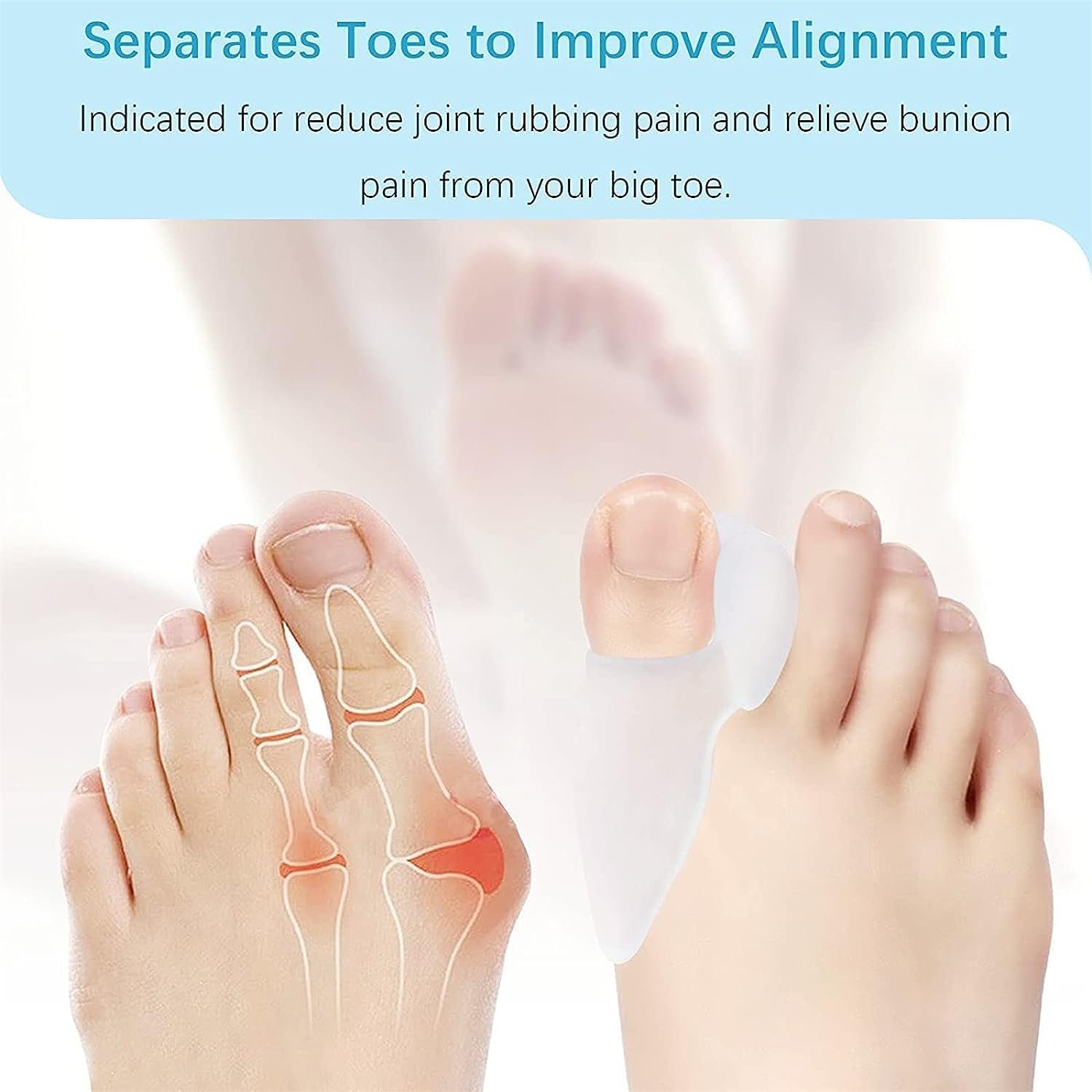 Подушечки для захисту від буньйону 12 шт., Захисна накладка, фото №5