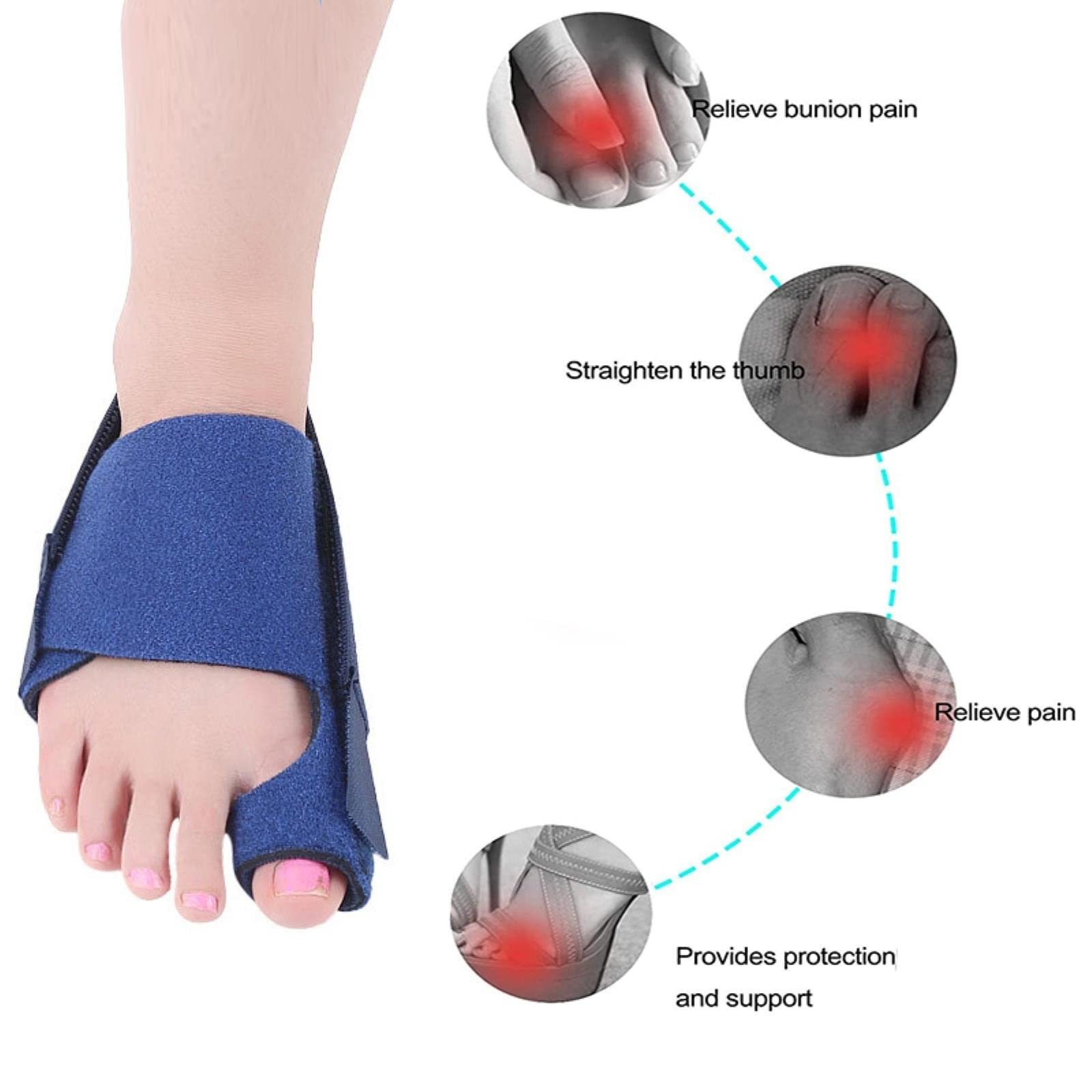 Коректор великого пальця стопи Bunion коректор Шина, фото №3 Коректор великого пальця стопи Bunion коректор Шина, фото №3