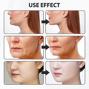 Ленты для лица (120 шт.) для подтяжки лица, для предотвращения морщин synthetic.ua - Фото 1