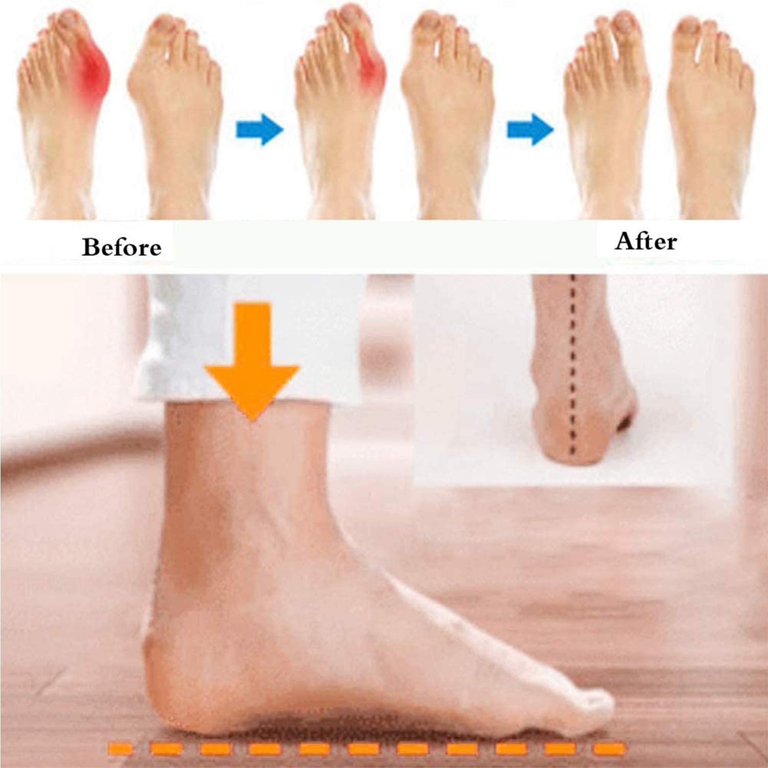 Женские Шлепанцы на платформе Леопардовый узор, фото №4