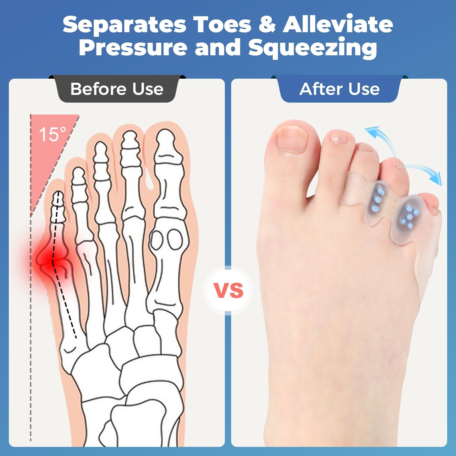 Випрямляч для деформованих та скривлених пальців ніг, фото №4