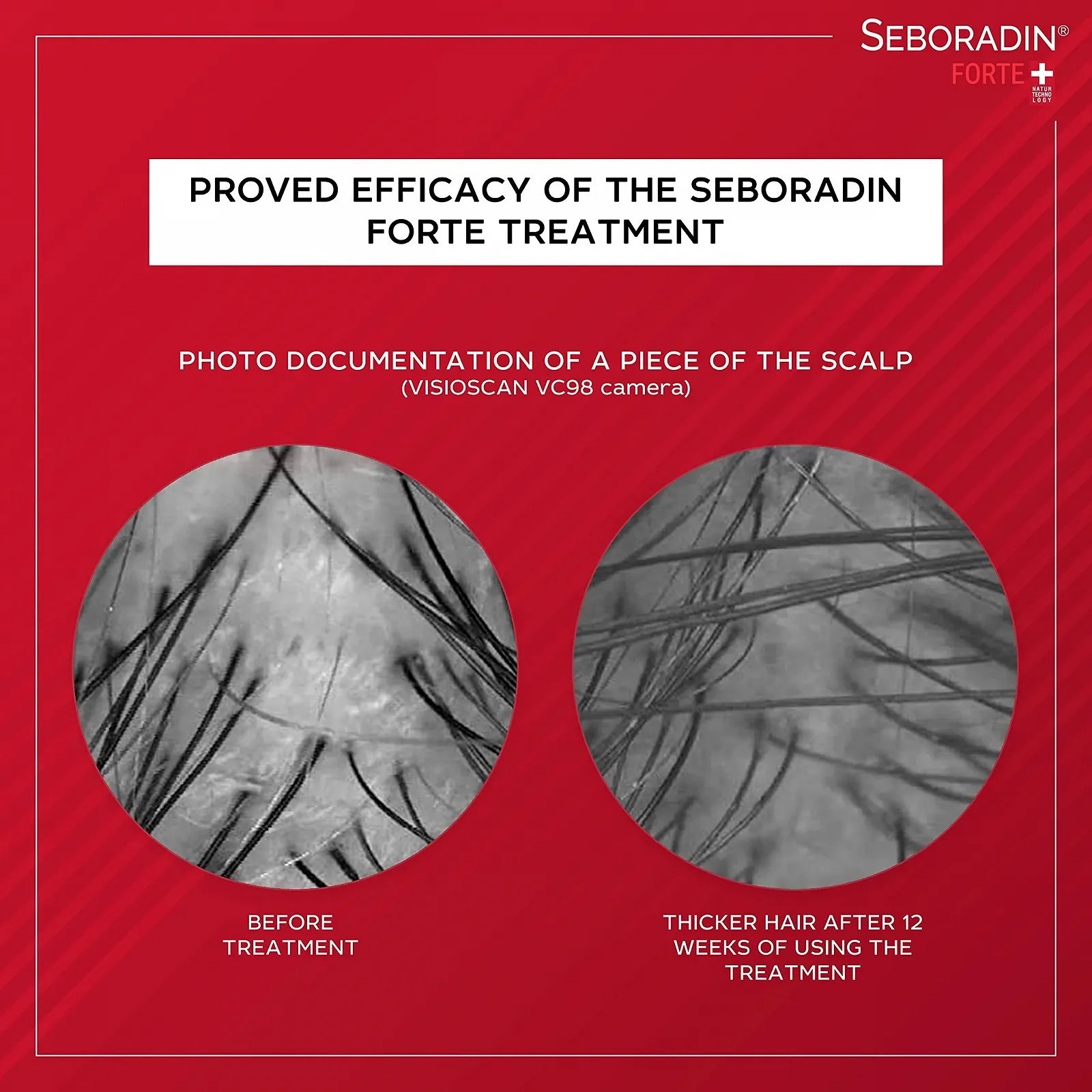 Лосьйон Seboradin Forte Проти випадіння волосся 200 мл, фото №7