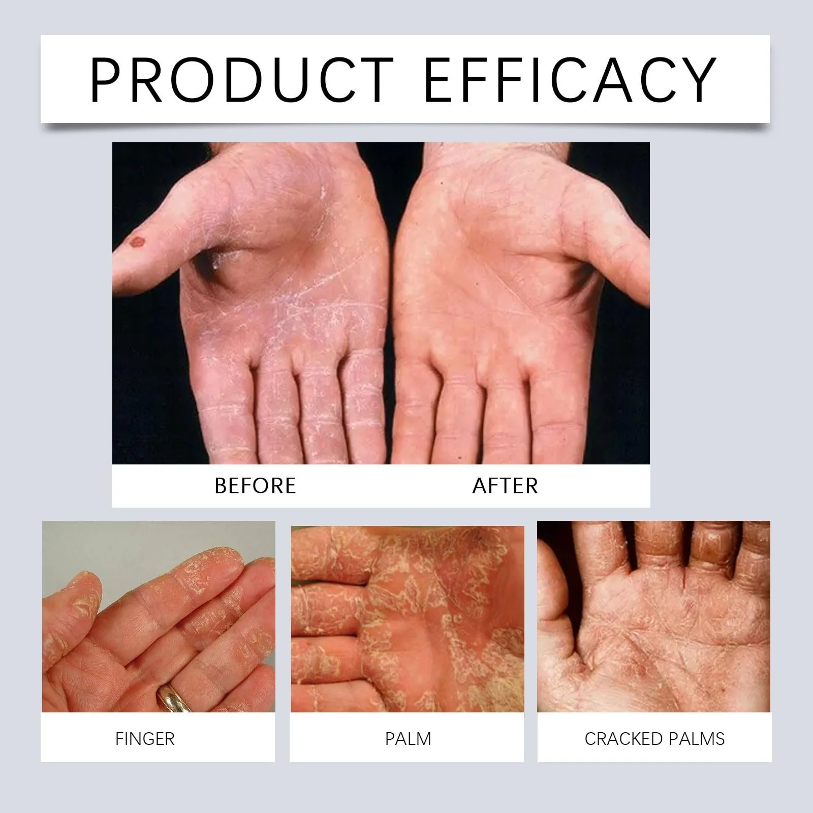 Крем для рук Fragrance Зволожуючий з олією авокадо, легка текстура, для чутливої шкіри, 2 шт, фото №3 Крем для рук Fragrance Зволожуючий з олією авокадо, легка текстура, для чутливої шкіри, 2 шт, фото №3