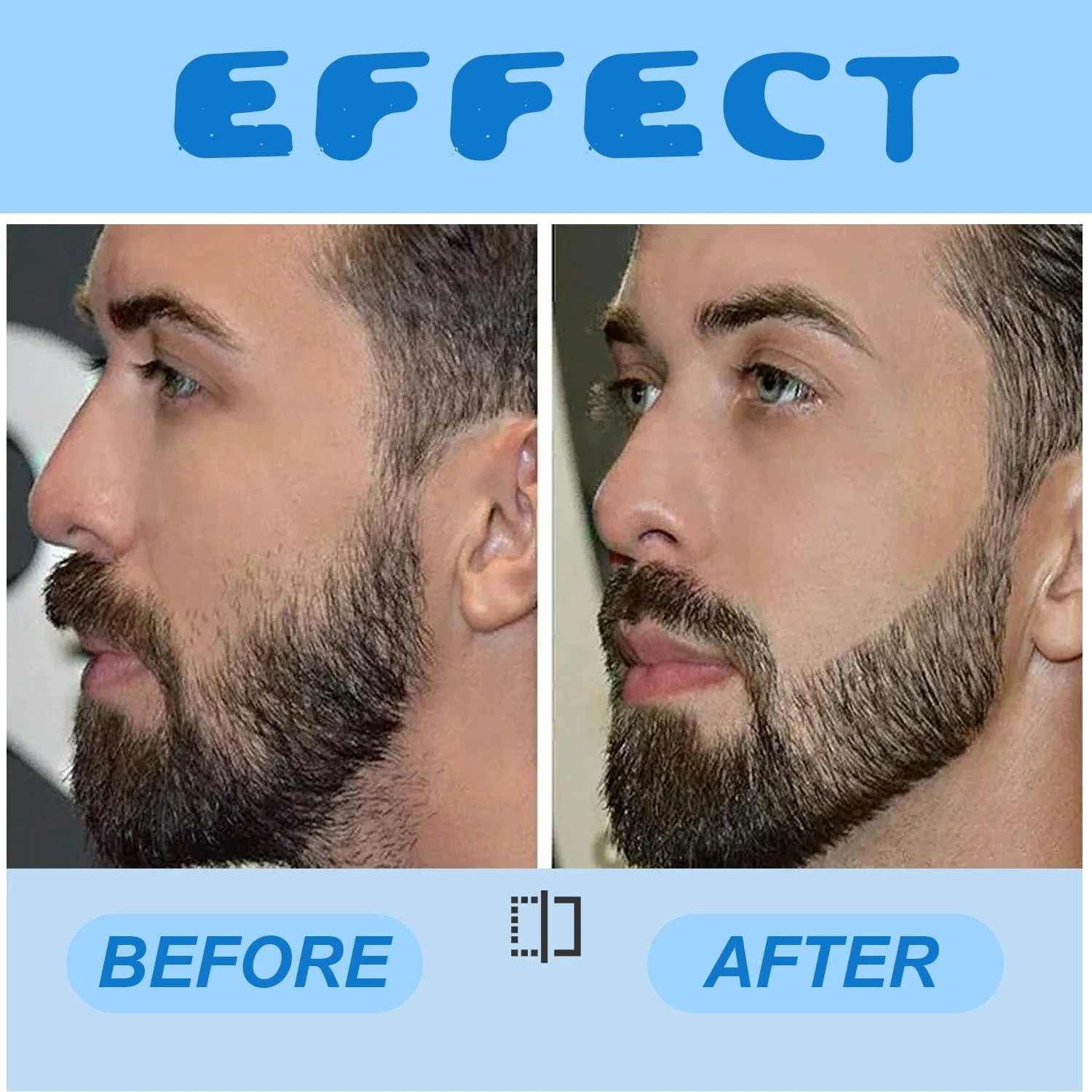 Ролик для бороди LATTCURE 0,5 мм, дермаролер для мікронідлінгу, 540 мікроголок з нержавіючої сталі, фото №6