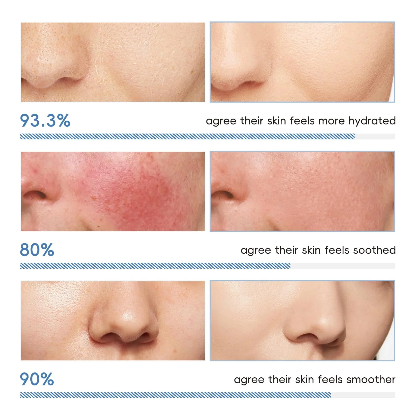 Набір для догляду за обличчям LAIKOU 7 x Ceramide, набір для догляду за шкірою для жінок з 5 предметів, фото №3