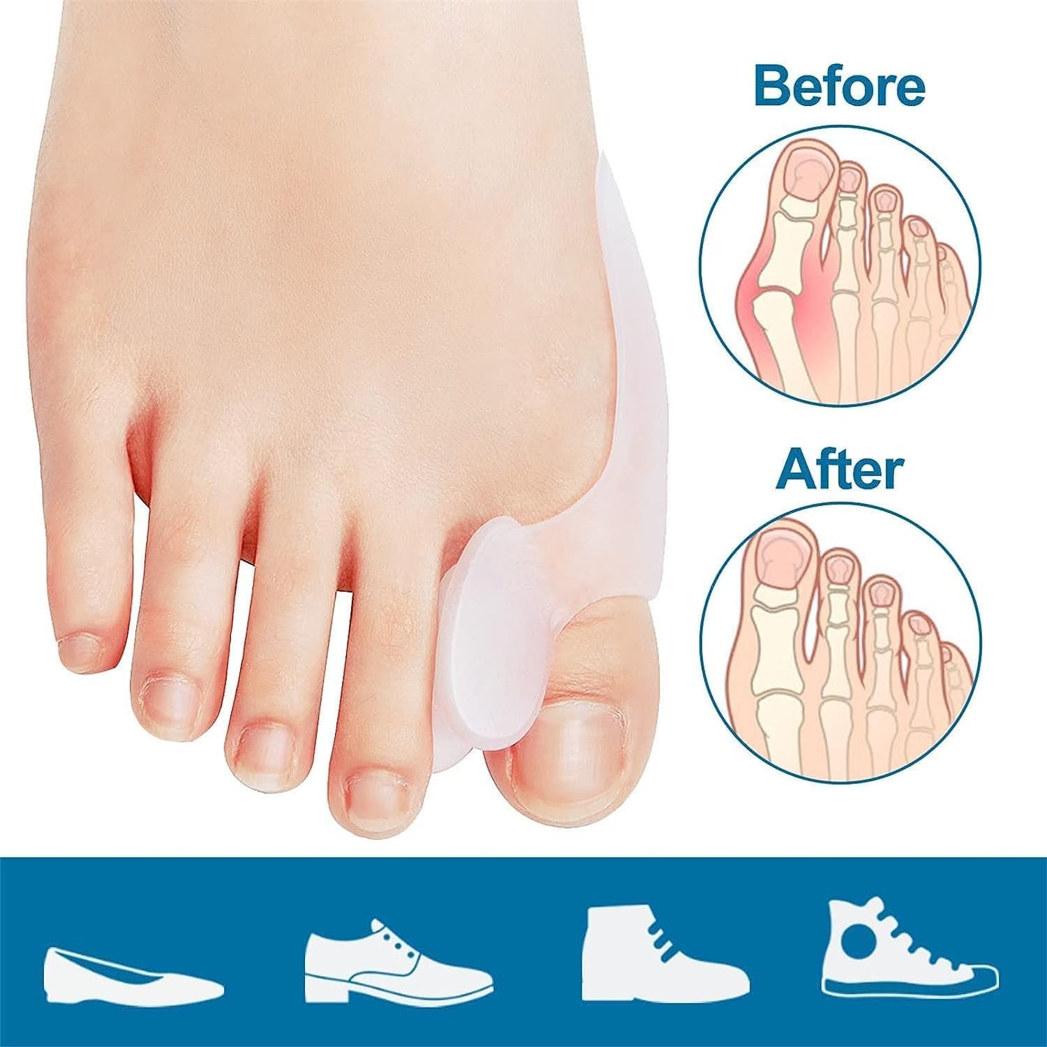 Подушечки для захисту від буньйону 12 шт., Захисна накладка, фото №7