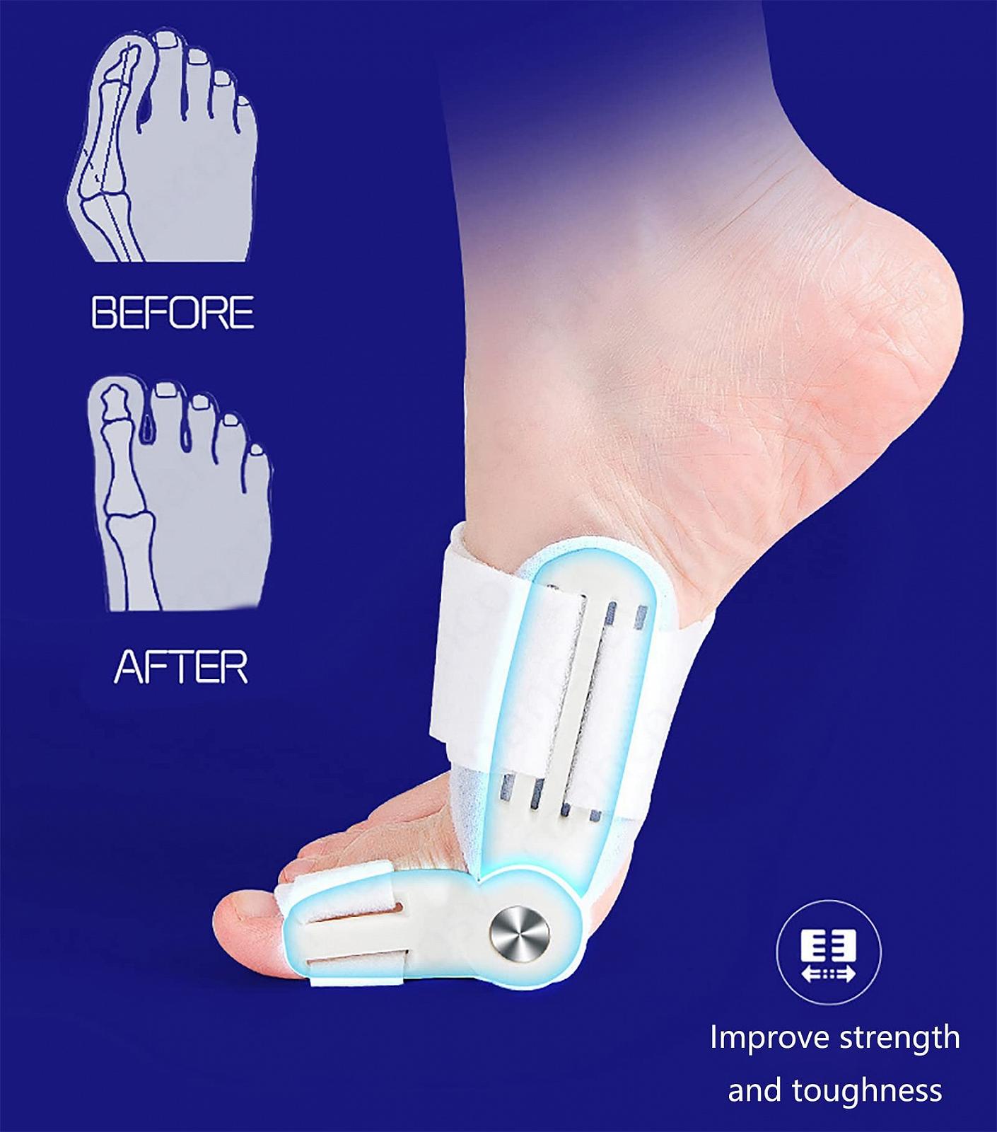 Коректор вальгусної деформації для жінок та чоловіків, фото №6 Коректор вальгусної деформації для жінок та чоловіків, фото №6