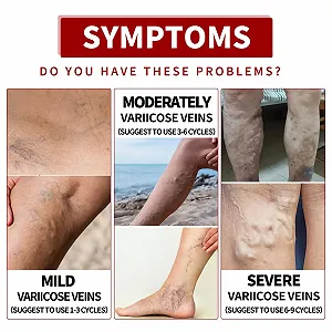 Крем для ухода за ногами Leg Care Cream synthetic.ua - Фото 1