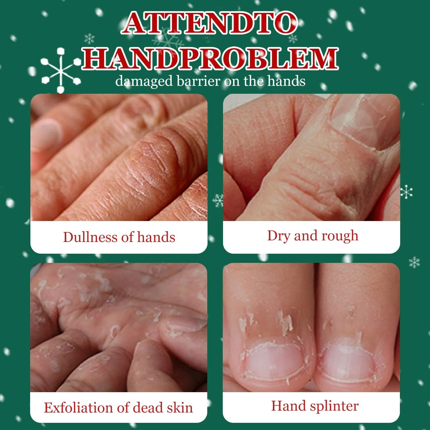 Крем для рук Набор Рождество, 5 шт Парфюмированный крем для рук, увлажняющий крем для рук и ног для сухой и потрескавшейся кожи рук, большой набор лосьона для рук для очень сухой кожи, фото №4