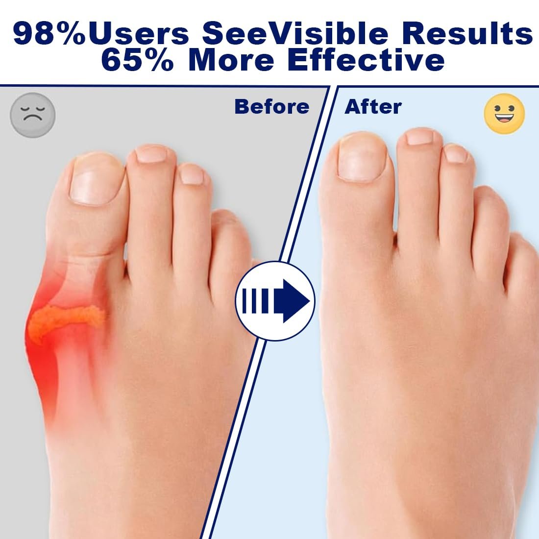 Шкарпетки Hallux Valgus (2 шт.) з силіконовими подушечками. Універсальний розмір для денного та нічного використання., фото №4