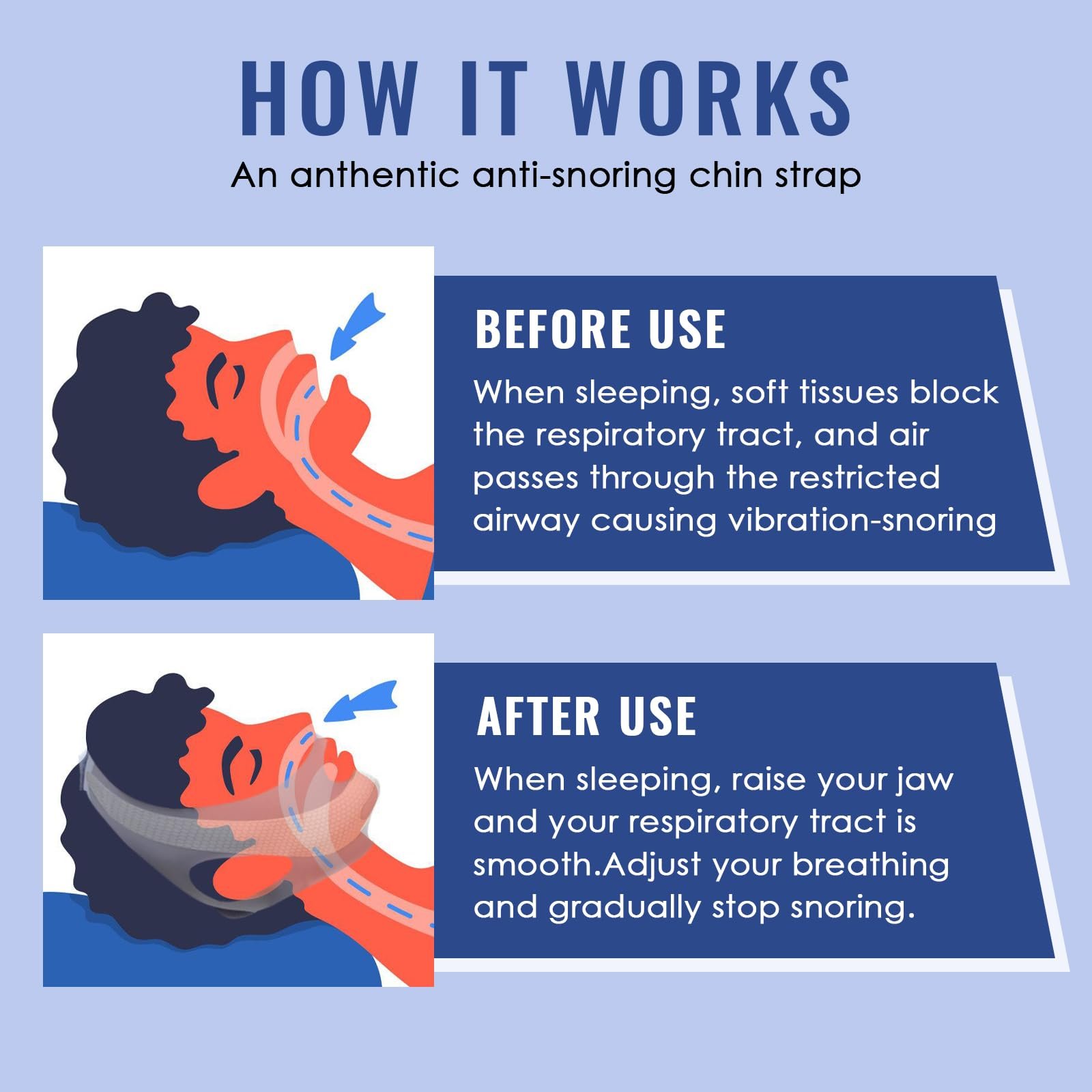 Ремінець на підборіддя проти хропіння, фото №5 Ремінець на підборіддя проти хропіння, фото №5