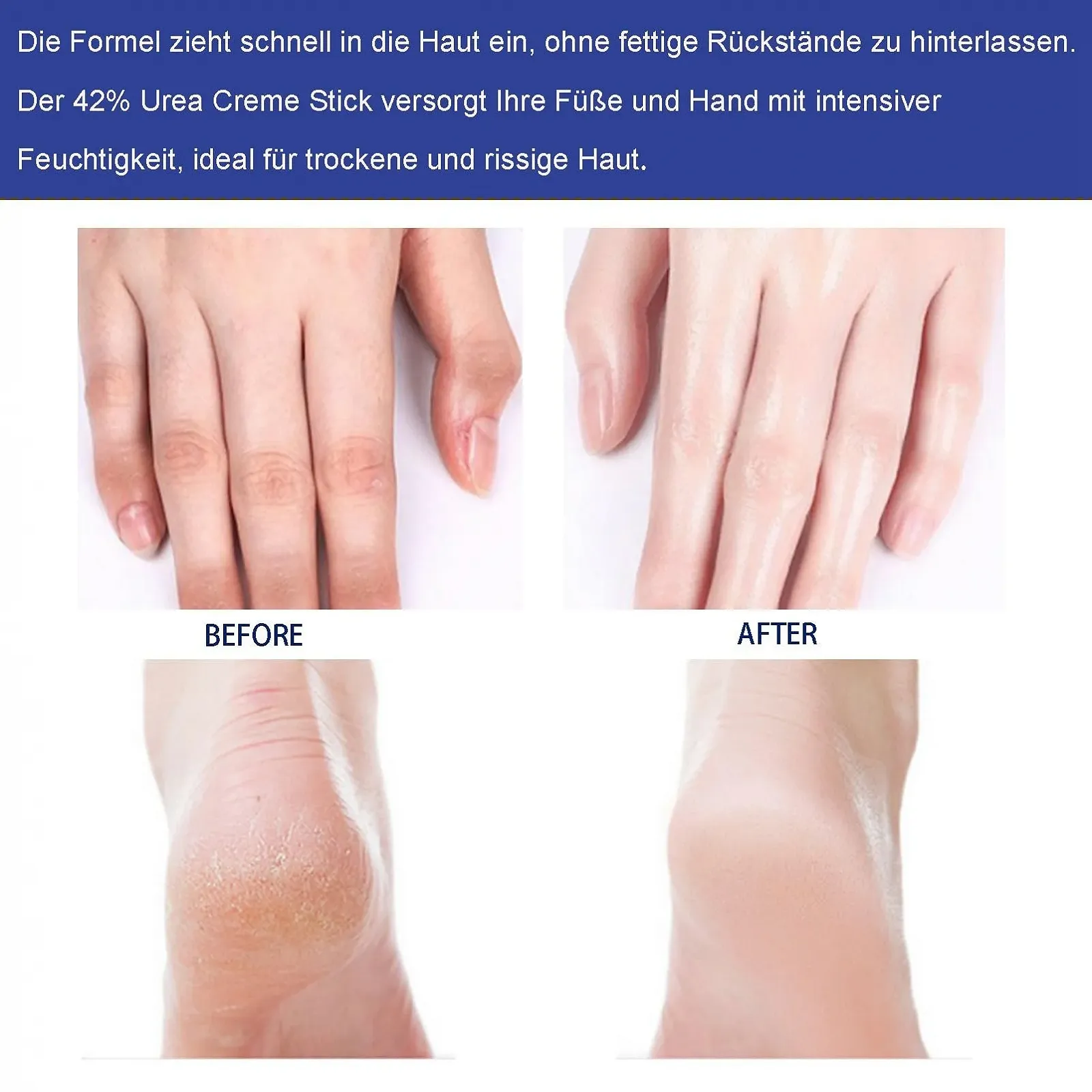 Крем-стик для ног Hydrating and Anti-Cracking 42% Urea для очень сухой кожи и удаления мозолей, фото №9