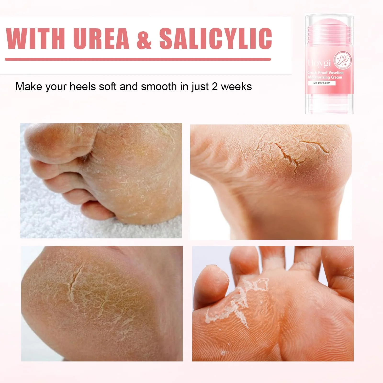 Крем для ног от мозолей и трещин с 60% мочевины и алоэ вера, фото №5 Крем для ног от мозолей и трещин с 60% мочевины и алоэ вера, фото №5