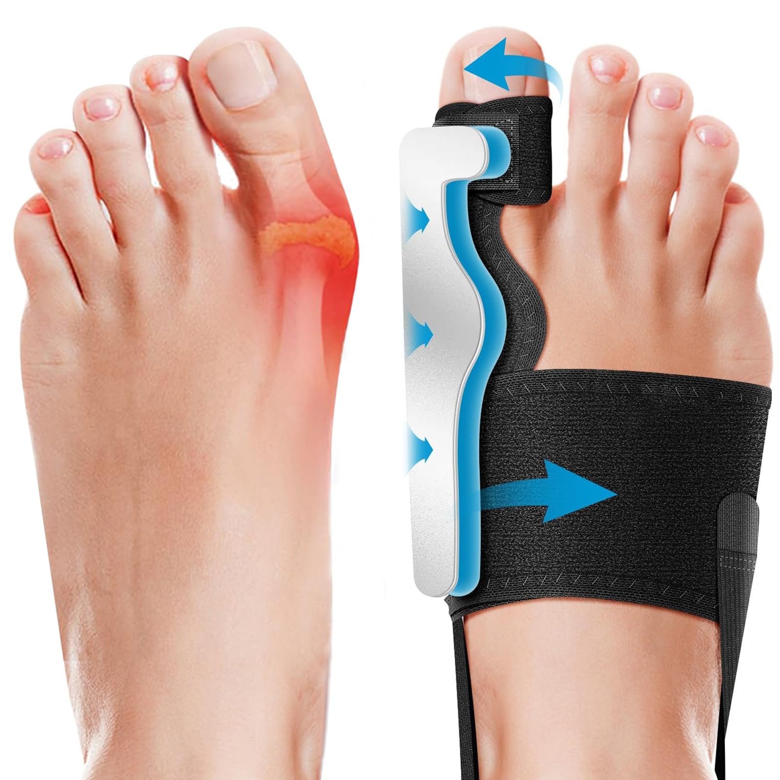 Шина для корекції Hallux Valgus, 2 x роздільники для пальців ніг, 2 x корекційні шини, регульована, фото №1