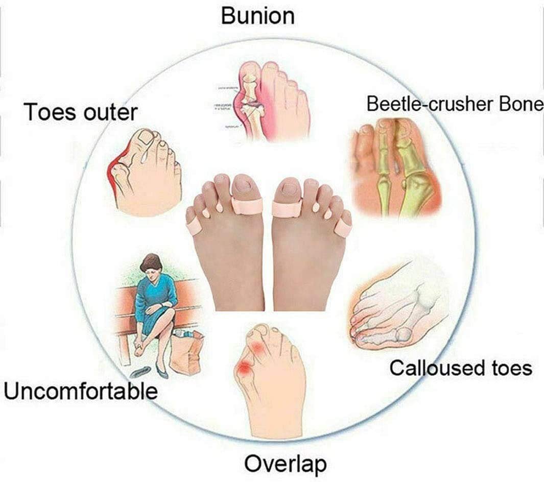 Роздільник для великого пальця стопи Ортопедичний Коректор Бурси 2.0 Бежевий, фото №2