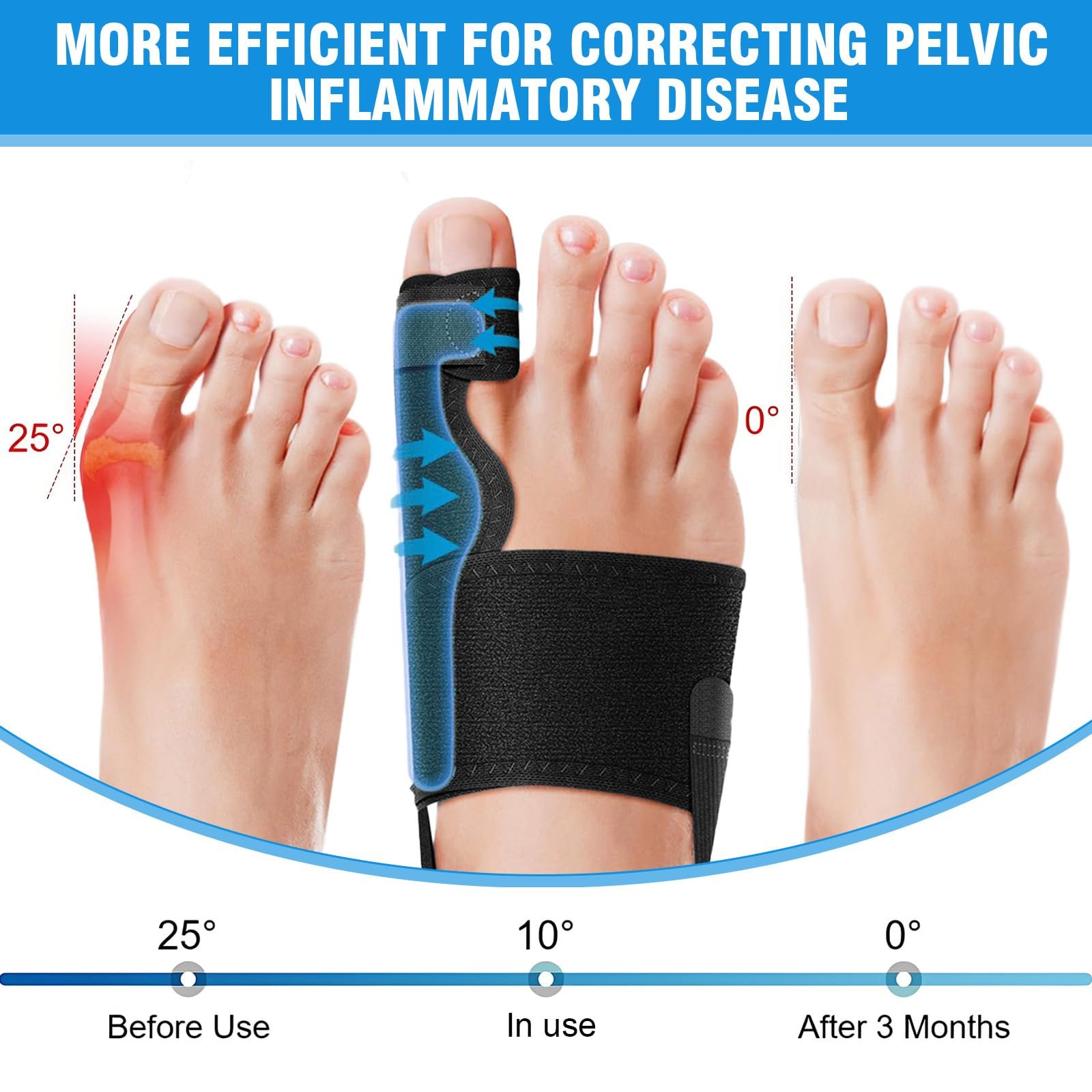 Коректор Hallux Valgus 2 шт. ортопедичний, універсальний розмір, фото №4 Коректор Hallux Valgus 2 шт. ортопедичний, універсальний розмір, фото №4