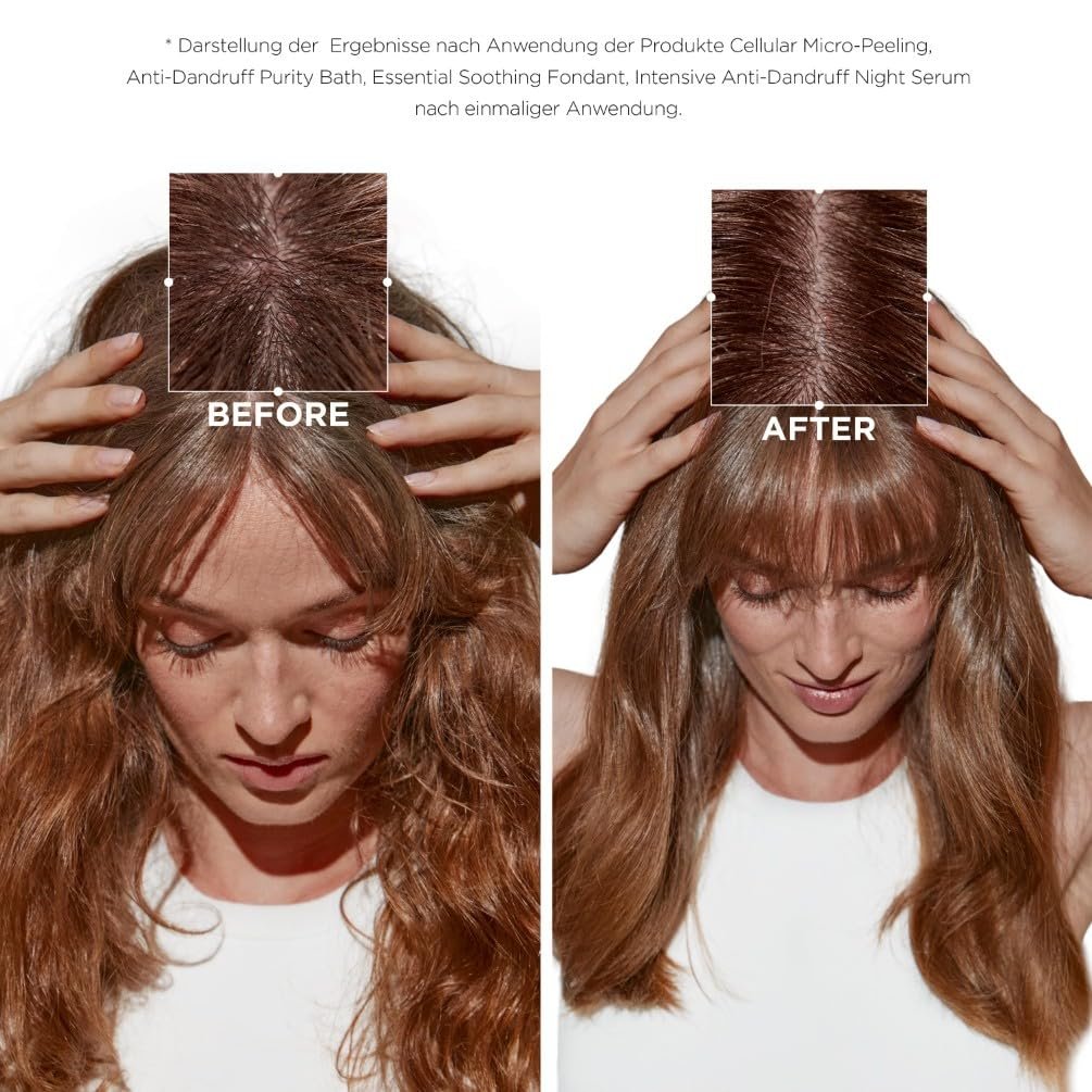 Шампунь Kérastase Symbiosis Увлажняющий против перхоти для сухой и чувствительной кожи головы Bain Crème Anti-Pelliculaire 250 мл, фото №3 Шампунь Kérastase Symbiosis Увлажняющий против перхоти для сухой и чувствительной кожи головы Bain Crème Anti-Pelliculaire 250 мл, фото №3