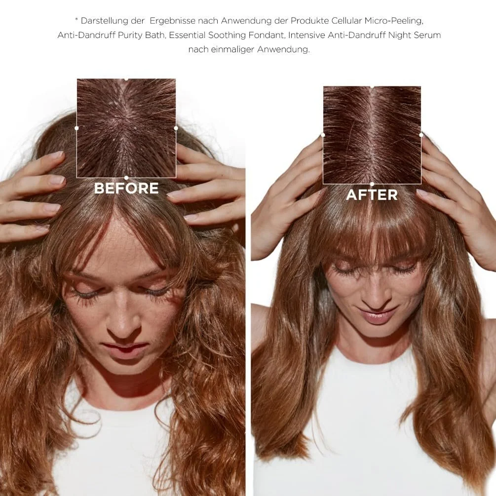 Шампунь Kérastase Symbiosis Зволожуючий проти лупи для сухої та чутливої шкіри голови Bain Crème Anti-Pelliculaire 250 мл, фото №3