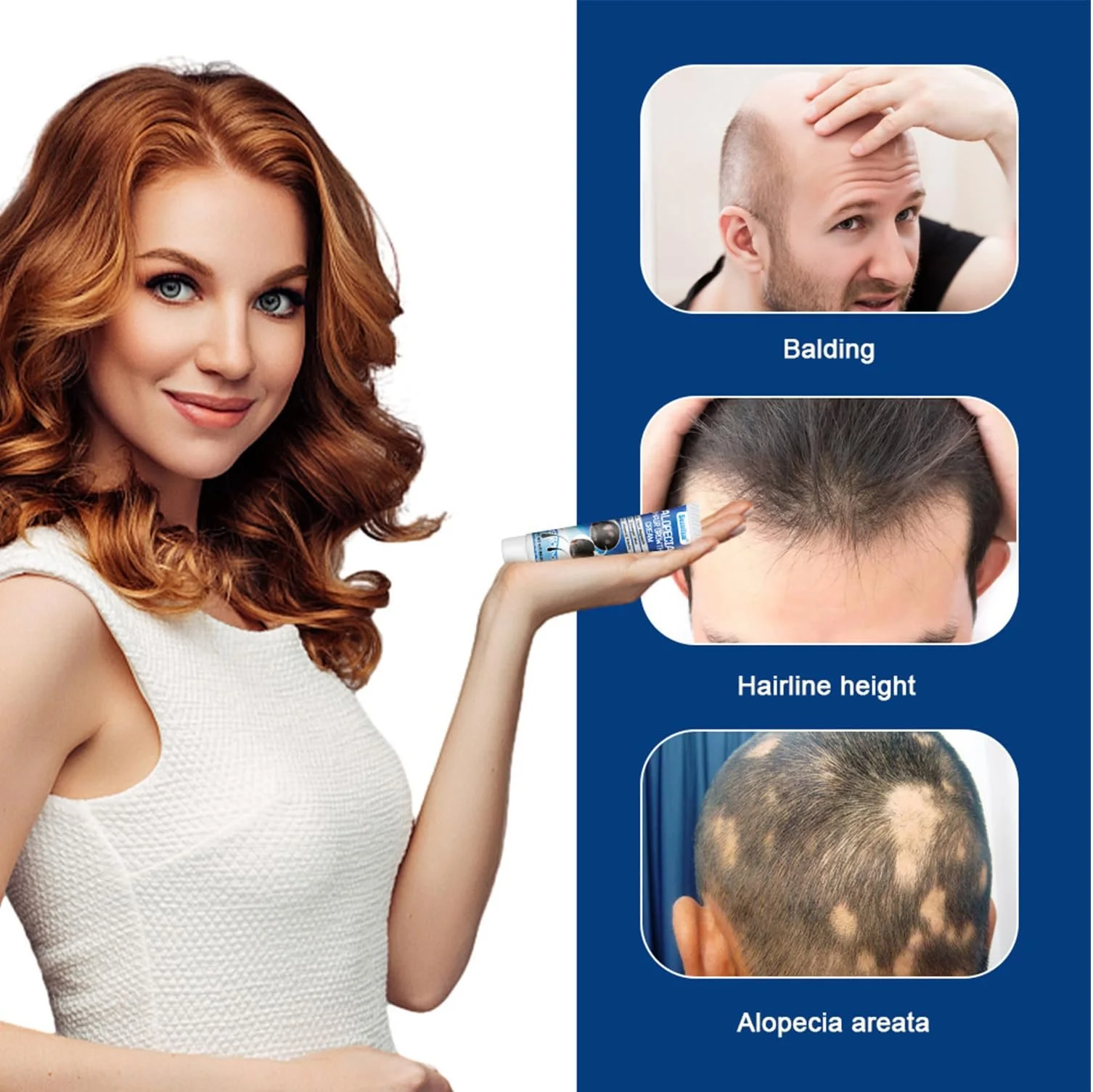 Крем против выпадения волос Cream, 20 г, ускоряет рост волос, эссенция для ухода за волосяными фолликулами, эффективный рост волос, фото №6