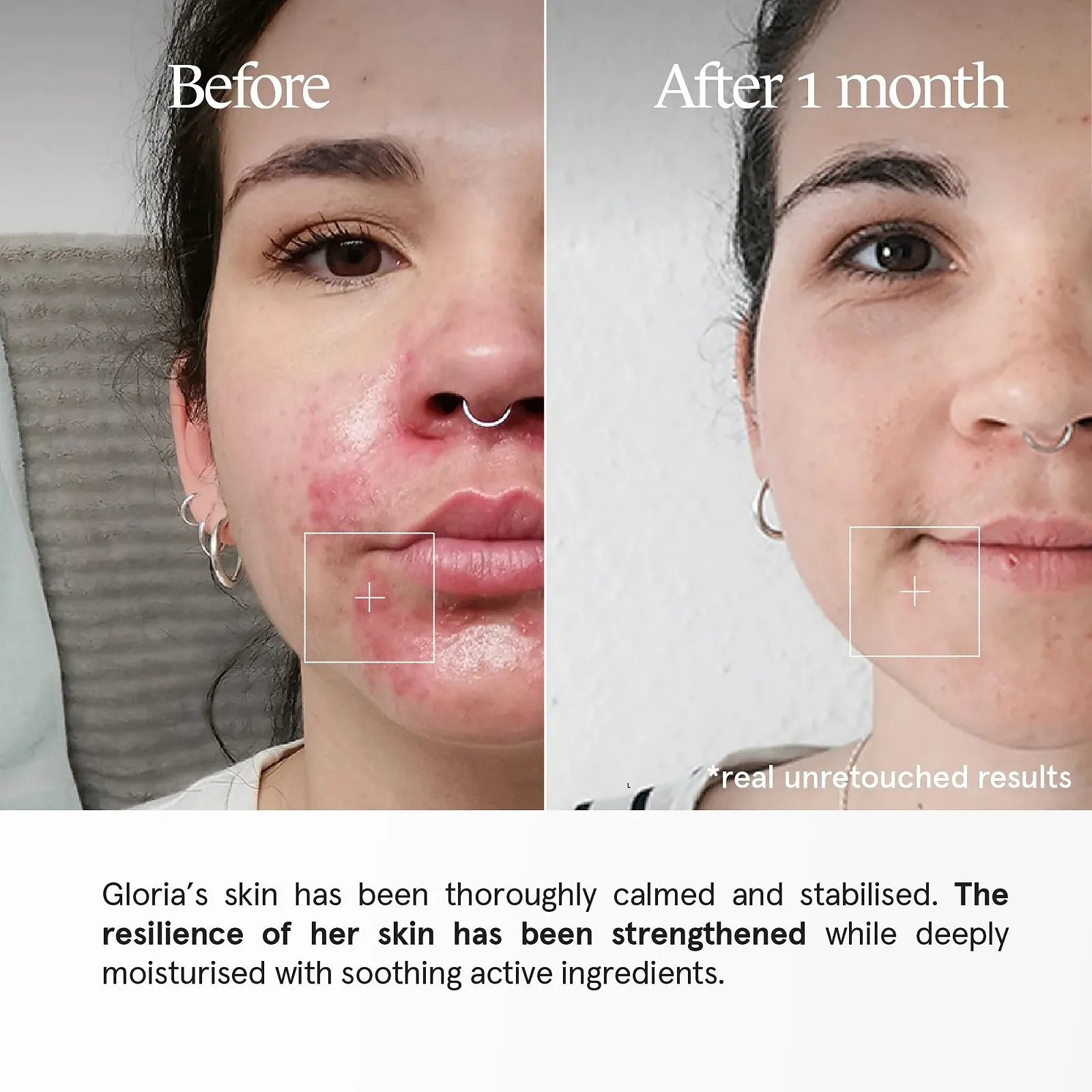 Уход для проблемной кожи Filabé Swiss Made Balanced Skin для профилактики проблем кожи, сужает поры, набор на 28 дней, веганский, без добавок, фото №6