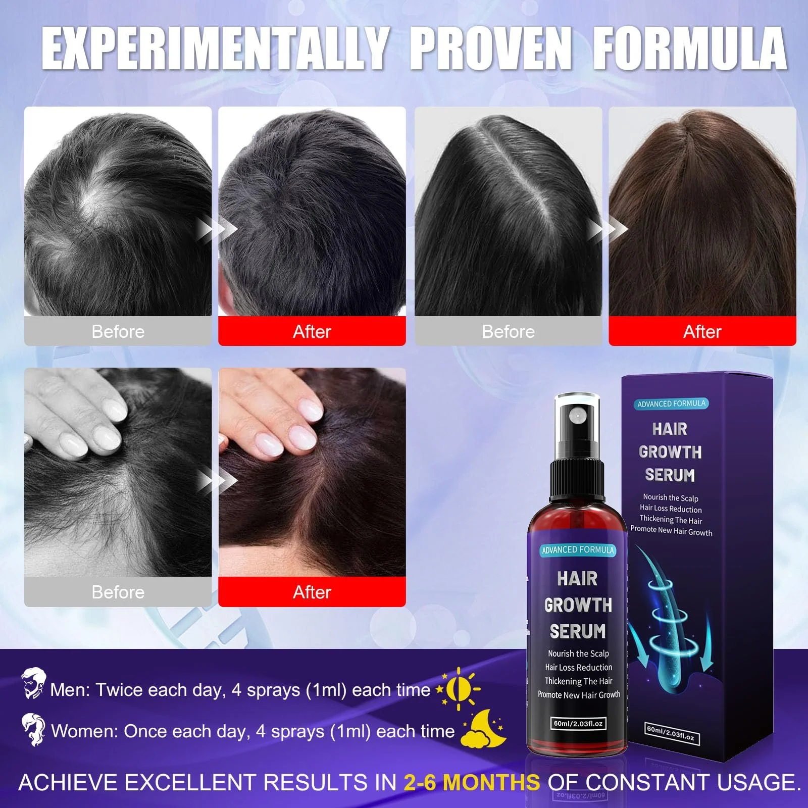 Сироватка-спрей для росту волосся з 5% активним інгредієнтом для чоловіків/жінок, фото №6