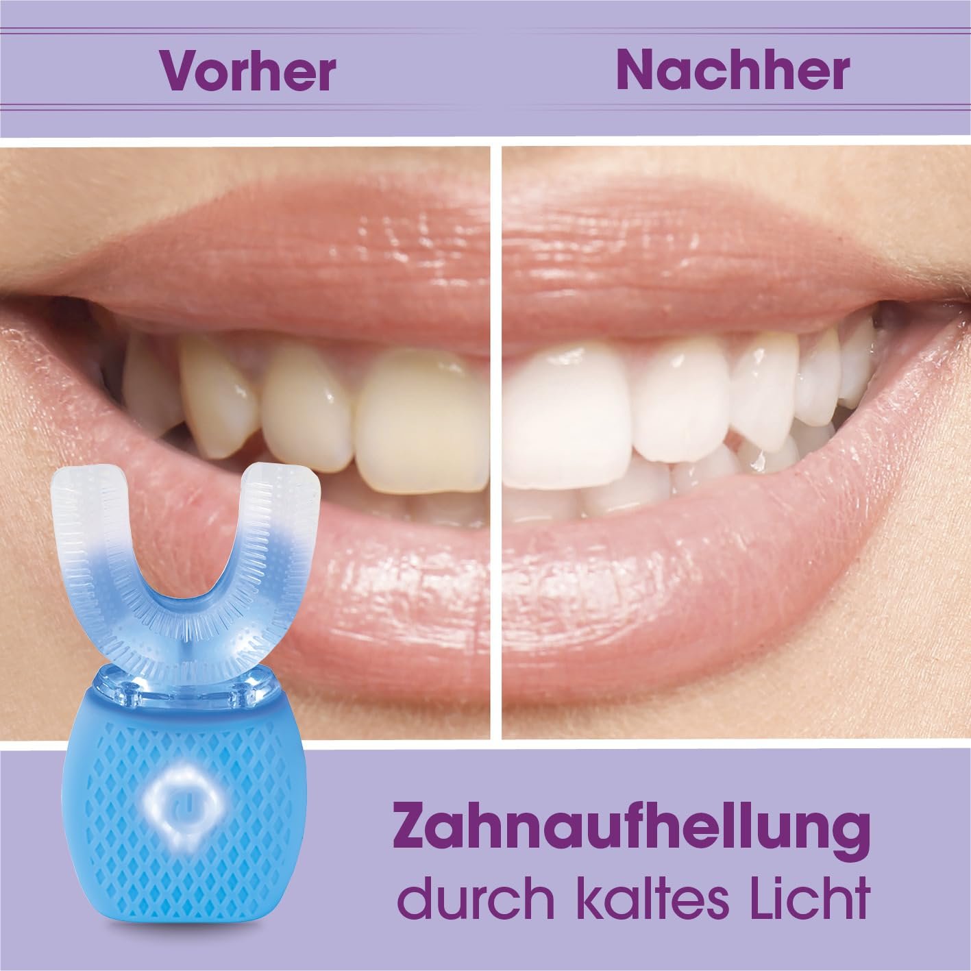 Ультразвукова зубна щітка VITALmaxx 360° 4 режими 15000 звукових вібрацій USB, фото №4